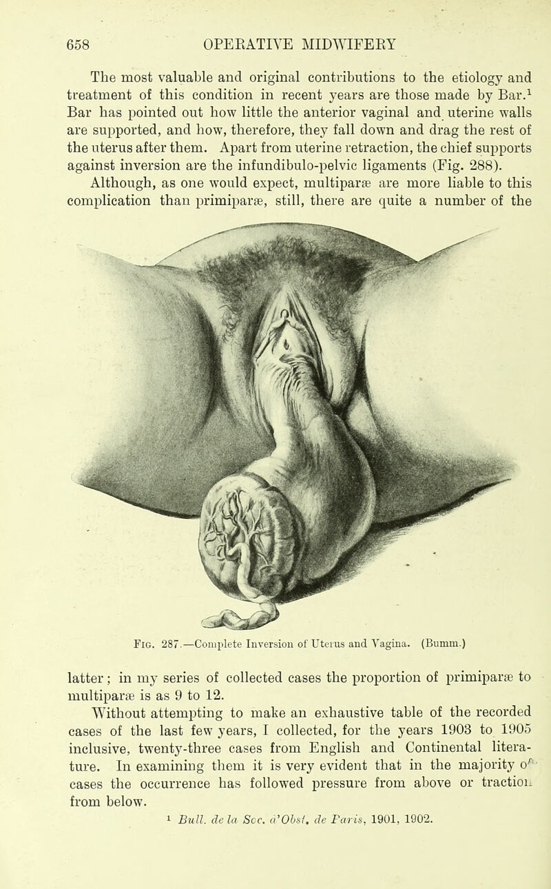 The most valuable and original contributions to the etiology and treatment of this condition in recent years are those made by Bar.^ Bar has pointed out how little the anterior vaginal and uterine walls are supported, and how, therefore, they fall down and drag the rest of the uterus after them. Apart from uterine retraction, the chief supports against inversion are the infundibulo-pelvic ligaments (Fig. 288). Although, as one would expect, multipart are more liable to this complication than primiparge, still, there are quite a number of the Fig. 287.—Complete Inversion of Uteius and Vagina. (Bumm.) latter; in my series of collected cases the proportion of primiparge to multiparae is as 9 to 12. Without attempting to make an exhaustive table of the recorded cases of the last few years, I collected, for the years 1903 to 1905 inclusive, twenty-three cases from English and Continental litera- ture. In examining them it is very evident that in the majority o''- cases the occurrence has followed pressure from above or tractioi. from below. 1 Bull, dela Sec. a'Obsf. de Paris, 1901, 1902.