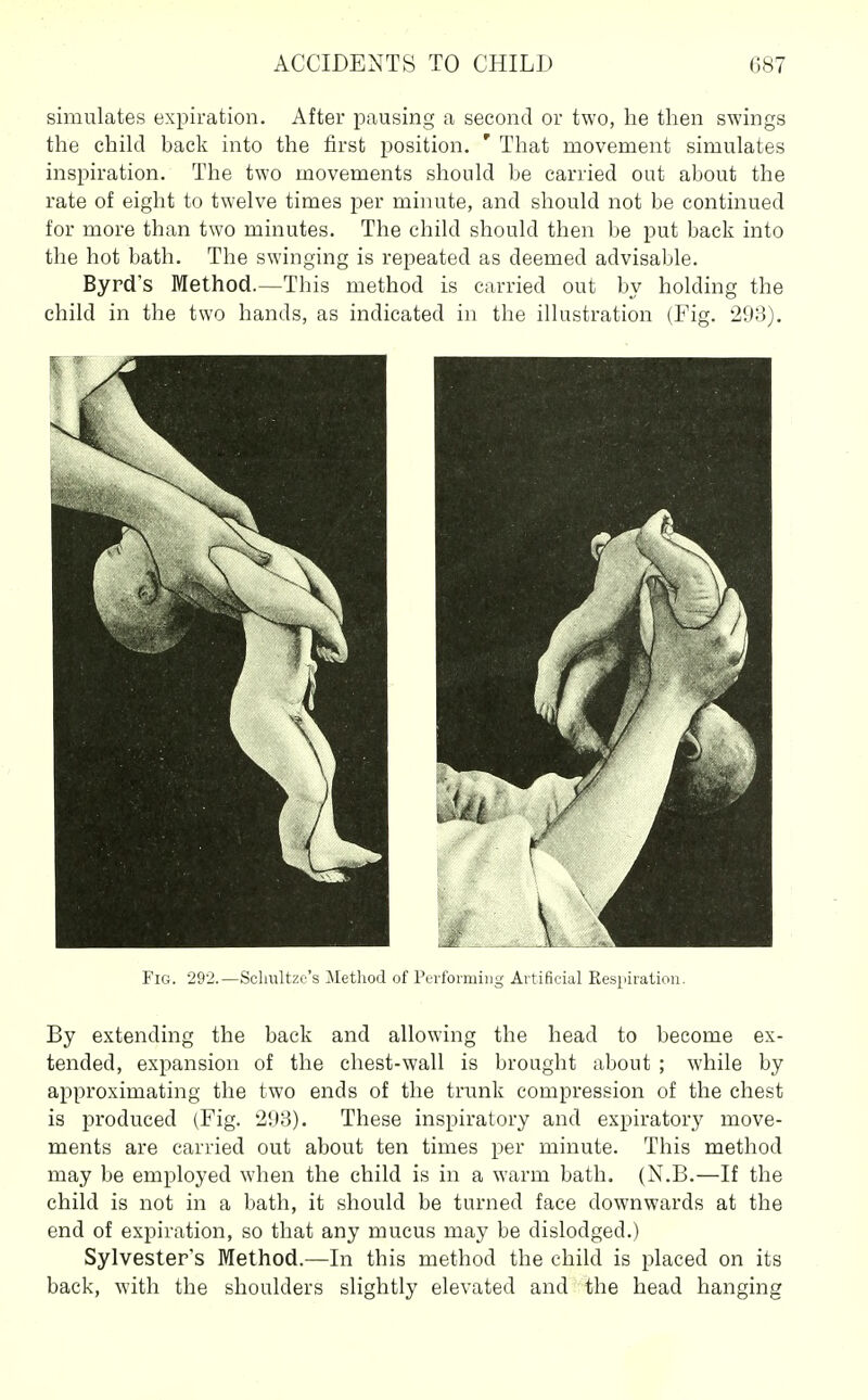 simulates expiration. After pausing a second or two, he then swings the child back into the first position. ' That movement simulates inspiration. The two movements should be carried out about the rate of eight to twelve times per minute, and should not be continued for more than two minutes. The child should then be put back into the hot bath. The swinging is repeated as deemed advisable. Byrd's Method.—This method is carried out by holding the child in the two hands, as indicated in the illustration (Fig. 293). Fig. 292.—Schliltze's iLetliod of Perfoimiiig Ai tiHtial Kespiiatioii. By extending the back and allowing the head to become ex- tended, expansion of the chest-wall is brought about ; while by approximating the two ends of the trunk compression of the chest is produced (Fig. 293). These inspiratory and expiratory move- ments are carried out about ten times per minute. This method may be employed when the child is in a warm bath. (N.B.—If the child is not in a bath, it should be turned face downwards at the end of expiration, so that any mucus may be dislodged.) Sylvester's Method.—In this method the child is placed on its back, with the shoulders slightly elevated and the head hanging