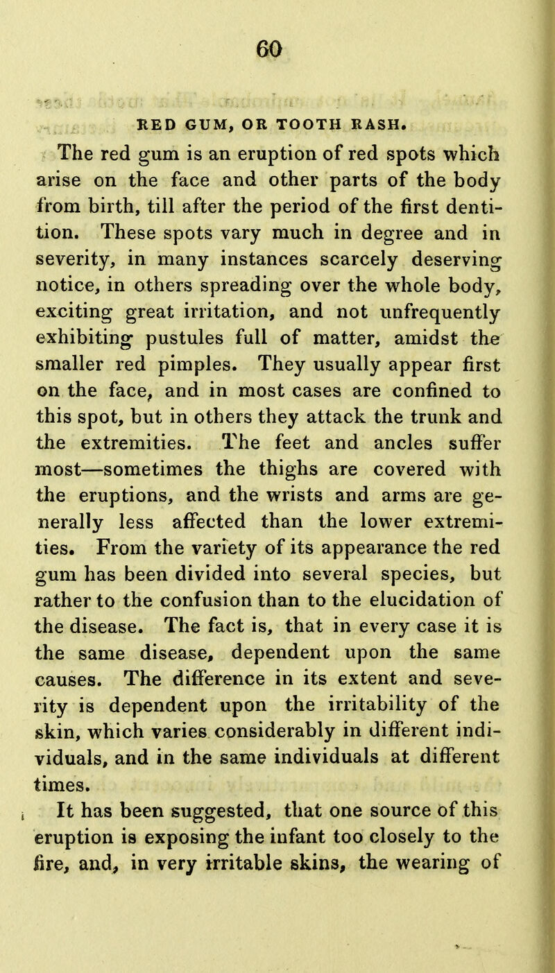 RED GUM, OR TOOTH RASH. The red gum is an eruption of red spots which arise on the face and other parts of the body from birth, till after the period of the first denti- tion. These spots vary much in degree and in severity, in many instances scarcely deserving notice, in others spreading over the whole body, exciting great irritation, and not unfrequently exhibiting pustules full of matter, amidst tbe smaller red pimples. They usually appear first on the face, and in most cases are confined to this spot, but in others they attack the trunk and the extremities. The feet and ancles suffer most—sometimes the thighs are covered with the eruptions, and the wrists and arms are ge- nerally less affected than the lower extremi- ties. From the variety of its appearance the red gum has been divided into several species, but rather to the confusion than to the elucidation of the disease. The fact is, that in every case it is the same disease, dependent upon the same causes. The difierence in its extent and seve- rity is dependent upon the irritability of the skin, which varies considerably in different indi- viduals, and in the same individuals at different times. It has been suggested, that one source of this eruption is exposing the infant too closely to the fire, and, in very irritable skins, the wearing of