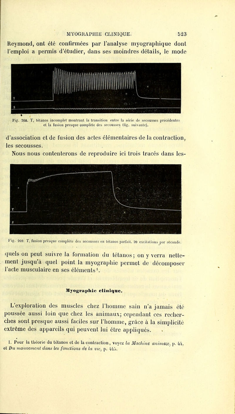 MYOGRAPHIE CLINIQUE. 523- Reymond, ont été confirmées par l'analyse myographique dont l'emploi a permis d'étudier, dans ses moindres détails, le mode Fig. 268. T, tétanos incomplet montrant la transition entre la série de secousses précédentes et la fusion presque complète des secousses dig. sui\ante). d'association et de fusion des actes élémentaires de la contraction, les secousses. Nous nous contenterons de reproduire ici trois tracés dans les- Fig. 269. T, fusion presque complète des secousses en lélanos parfait. 20 excitations par stconde. quels on peut suivre la formation du tétanos ; on y verra nette- ment jusqu'à quel point la myograi)liie permet de décomposer l'acte musculaire en ses éléments ^ Myograpliie clinique. L'exploration des muscles chez l'homme sain n'a jamais été poussée aussi loin que chez les animaux; cependant ces recher- ches sont presque aussi faciles sur l'homme, grâce à la simplicité extrême des appareils qui peuvent lui être appliqués. 1. Pour la théorie du tétanos et de la contraction, voyez la Machine aniinaie. i>. 44. et Du mouveinoit dans les fondions de la vie, p. 44j.