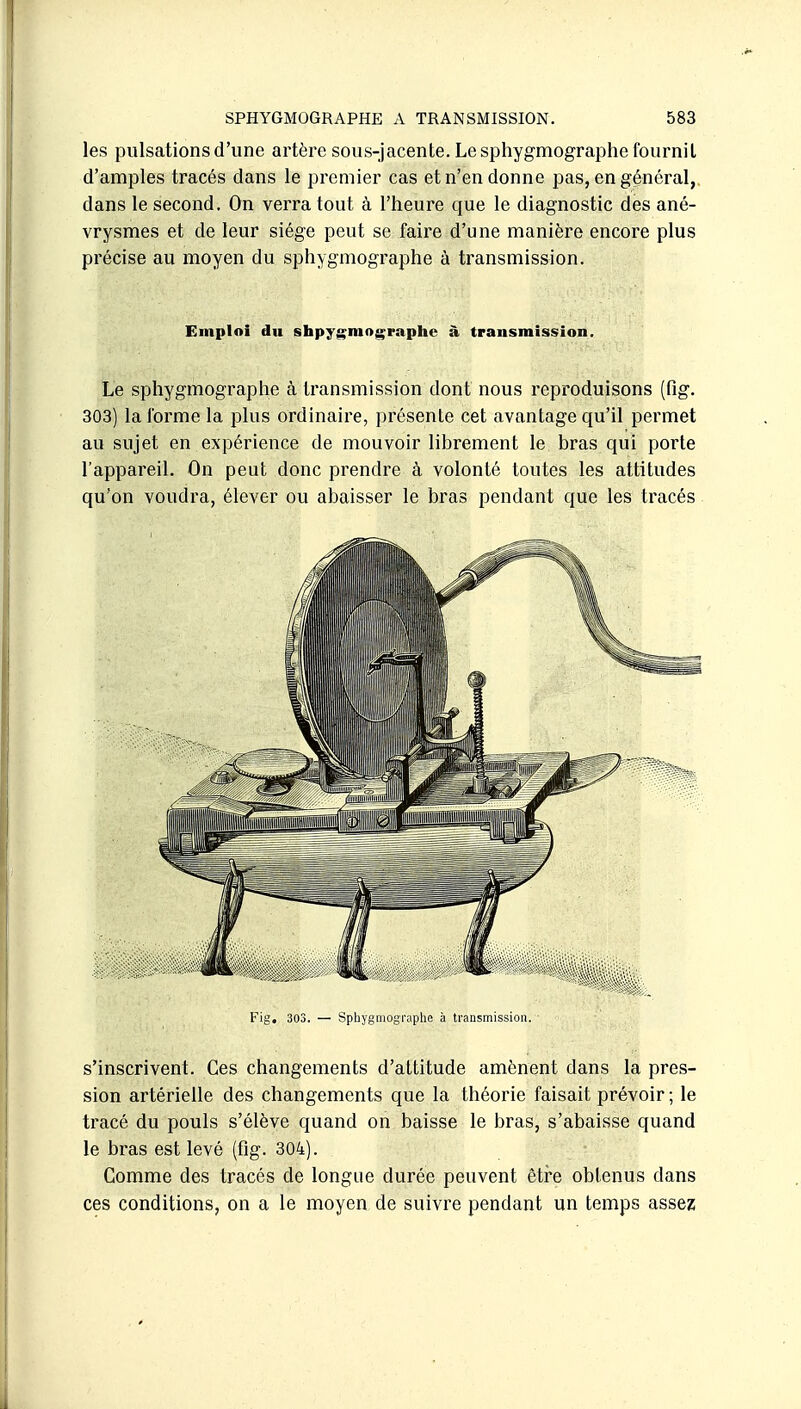 les pulsations d'une artère sous-jacente. Le spliygmograiDhe fournil d'amples tracés dans le premier cas et n'en donne pas, en général, dans le second. On verra tout à l'heure que le diagnostic des ané- vrysmes et de leur siège peut se faire d'une manière encore plus précise au moyen du sphygmographe à transmission. Emploi du shpygmo^^raphe à transmission. Le sphygmographe à transmission dont nous reproduisons (fig. 303) la forme la plus ordinaire, présente cet avantage qu'il peiTOet au sujet en expérience de mouvoir librement le bras qui porte l'appareil. On peut donc prendre à volonté toutes les attitudes qu'on voudra, élever ou abaisser le bras pendant que les tracés Fig, 303. — Sphygmographe à transmissiuii. s'inscrivent. Ces changements d'attitude amènent dans la pres- sion artérielle des changements que la théorie faisait prévoir ; le tracé du pouls s'élève quand on baisse le bras, s'abaisse quand le bras est levé (fig. 304). Comme des tracés de longue durée peuvent être obtenus dans ces conditions, on a le moyen de suivre pendant un temps assez