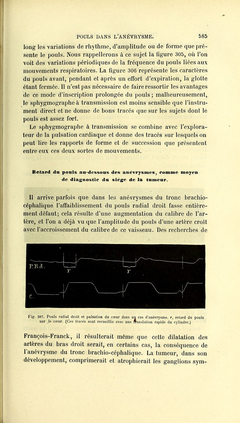 long les variations de rhythme, d'amplitude ou de forme que pré- sente le pouls. Nous rappellerons à ce sujet la figure 305, où l'on voit des variations périodiques de la fréquence du pouls lices aux mouvements respiratoires. La figure 306 représente les caractères du pouls avant, pendant et après un effort d'expiration, la glotte étant fermée. Il n'est pas nécessaire de faire ressortir les avantages de ce mode d'inscription prolongée du pouls ; malheureusement, le sphygmographe à transmission est moins sensible que l'instru- ment direct et ne donne de bons tracés que sur les sujets dont le pouls est assez fort. Le sphygmographe à transmission se combine avec l'explora- teur de la pulsation cardiaque et donne des tracés sur lesquels on peut lire les rapports de forme et de succession que présentent entre eux ces deux sortes de mouvements. Retard ilu pouls au-dessous des anévrysnies, comme moyen de diagnostic du siège de la tumeur. Il arrive parfois que dans les anévrysmes du tronc brachio- céphalique l'affaiblissement du pouls radial droit fasse entière- ment défaut; cela résulte d'une augmentation du calibre de l'ar- tère, et l'on a déjà vu que l'amplitude du pouls d'une artère croît avec l'accroissement du calibre de ce vaisseau. Des recherches de p.R.a. ' — . Y 1 /- ~ \~~—-' \ / / ■ .y c. ' 1 — 1 Fig. 307. Pouls radial droit et pulsation du cœur dans un cas d'anévrysme. r, relard du pouls sur > creur. (Ces tracés sont recueillis avec une ffanslation rapide du cylindre.) François-Franck, il résulterait même que cette dilatation des artères du bras droit serait, en certains cas, la conséquence de lanévrysme du tronc brachio-céphalique. La tumeur, dans son développement, comprimerait et atrophierait les ganglions sym-