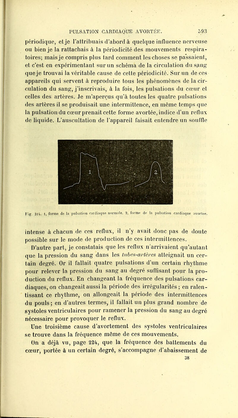 périodique, et je l'attribuais d'abord à quelque influence nerveuse ou bien je la rattachais à la périodicité des mouvements respira- toires; mais je compris plus tard comment les choses se passaient, et c'est en expérimentant sur un schéma de la circulation du s.ang que je trouvai la véritable cause de cette périodicité. Sur un de ces appareils qui servent à reproduire tous les phénomènes de la cir- culation du sang, j'inscrivais, à la fois, les pulsations du cœur et celles des artères, .le m'aperçus qu'à toutes les quatre pulsations des artères il se produisait une intermittence, en même temps que la pulsation du cœur prenait cette forme avortée, indice d'un rellux de liquide. L'auscultation de l'appareil faisait entendre un sourde 1 ■ A ^^^^^^ ,v Fig. 31'i. I, forme de la piiUnlinn i-nrdinqiie normale. 2, forme de la piilsnlioii cardinf|ue .ivorlee. intense à chacun de ces reflux, il n'y avait donc pas de doute possible sur le mode de production de ces intermittences. D'autre part, je constatais que les reflux n'arrivaient qu'autant que la pression du sang dans les tubes-artères atteignait un cer- tain degré. Or il fallait quatre pulsations d'un certain rhythme pour relever la pression du sang au degré suffisant pour la pro- duction du reflux. En changeant la fréquence des pulsations car- diaques, on changeait aussi la période des irrégularités ; en ralen- tissant ce rhythme, on allongeait la période des intermittences du pouls; en d'autres termes, il fallait un plus grand nombre de systoles ventriculaires pour ramener la pression du sang au degré nécessaire pour provoquer le reflux. Une troisième cause d'avortement des systoles ventriculaires se trouve dans la fréquence même de ces mouvements. On a déjà vu, page 224, que la fréquence des battements du cœur, portée à un certain degré, s'accompagne d'abaissement de 38