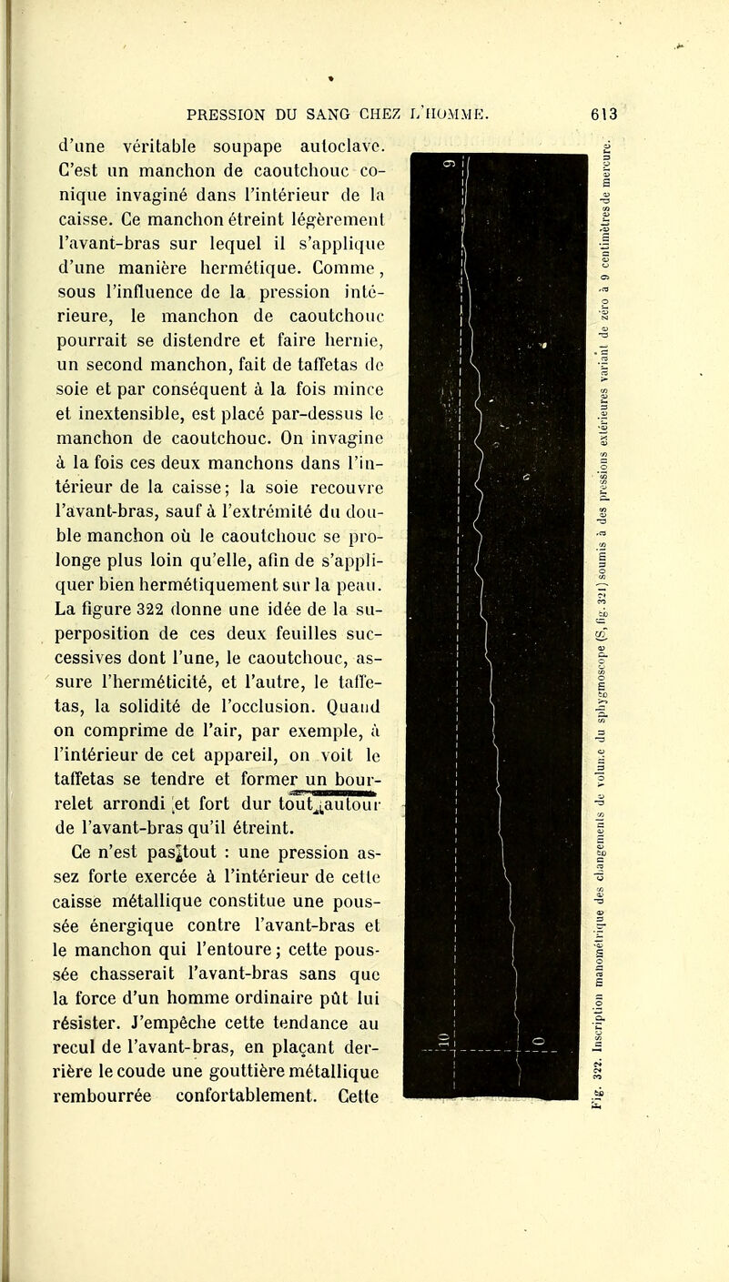 d'une véritable soupape autoclave. C'est un manchon de caoutchouc co- nique invaginé dans l'intérieur de la caisse. Ce manchon étreint légèrement l'avant-bras sur lequel il s'applique d'une manière hermétique. Comme, sous l'influence de la pression inté- rieure, le manchon de caoutchouc pourrait se distendre et faire hernie, un second manchon, fait de taffetas de soie et par conséquent à la fois mince et inextensible, est placé par-dessus le manchon de caoutchouc. On invagine à la fois ces deux manchons dans l'in- térieur de la caisse; la soie recouvre l'avant-bras, sauf à l'extrémité du dou- ble manchon où le caoutchouc se pro- longe plus loin qu'elle, afin de s'appli- quer bien hermétiquement sur la peau. La figure 322 donne une idée de la su- perposition de ces deux feuilles suc- cessives dont l'une, le caoutchouc, as- sure l'herméticité, et l'autre, le taffe- tas, la solidité de l'occlusion. Quand on comprime de l'air, par exemple, à l'intérieur de cet appareil, on voit le taffetas se tendre et former un bour- relet arrondi !et fort dur tout^i.autour de l'avant-bras qu'il étreint. Ce n'est paspout : une pression as- sez forte exercée à l'intérieur de cette caisse métallique constitue une pous- sée énergique contre l'avant-bras et le manchon qui l'entoure ; cette pous- sée chasserait l'avant-bras sans que la force d'un homme ordinaire pût lui résister. J'empêche cette tendance au recul de l'avant-bras, en plaçant der- rière le coude une gouttière métallique rembourrée confortablement. Cette