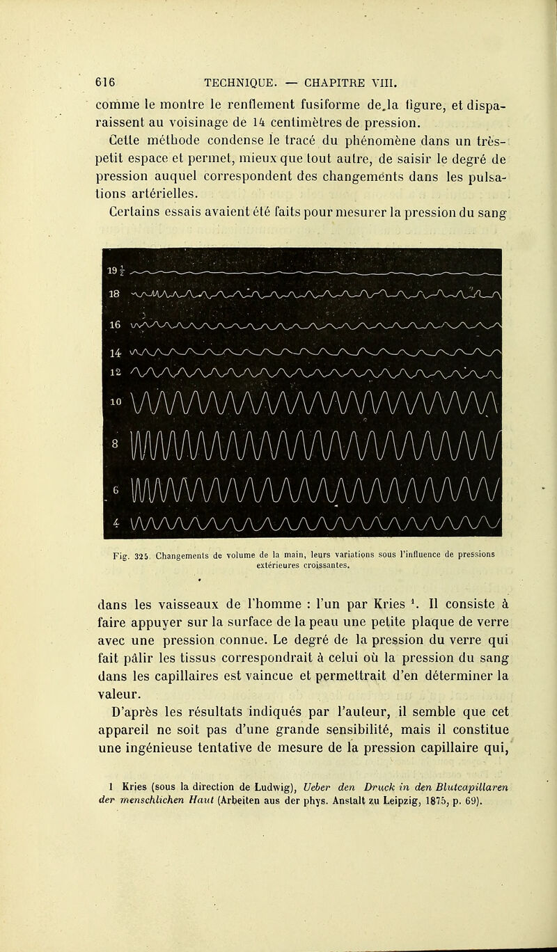 comme le montre le renflement fusiforme de.la figure, et dispa- raissent au voisinage de 14 centimètres de pression. Cette méthode condense le tracé du phénomène dans un très- petit espace et permet, mieux que tout autre, de saisir le degré de pression auquel correspondent des changements dans les pulsa- tions artérielles. Certains essais avaient été faits pour mesurer la pression du sang Fig. 325 Changemenls de volume de la main, leurs variations sous l'influence de pressions extérieures croissantes. dans les vaisseaux de l'homme : l'un par Kries Il consiste à faire appuyer sur la surface de la peau une petite plaque de verre avec une pression connue. Le degré de la pression du verre qui fait pâlir les tissus correspondrait à celui oia la pression du sang dans les capillaires est vaincue et permettrait d'en déterminer la valeur. D'après les résultats indiqués par l'auleur, il semble que cet appareil ne soit pas d'une grande sensibiUté, mais il constitue une ingénieuse tentative de mesure de la pression capillaire qui, 1 Kries (sous la direction de Ludwig), Ueber den Druck in den Blutcapillaren der menschlichen Haut (Arbeiten aus der phys. Anslalt zu Leipzig, 1875, p. 69).