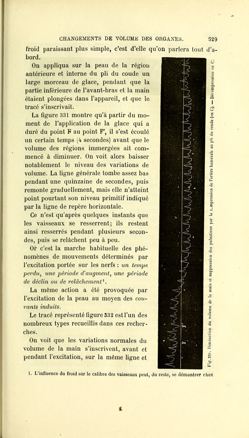 froid paraissant plus simple, c'est d'elle qu'on parlera tout d'a- bord. On appliqua sur la peau de la région antérieure et interne du pli du coude un large morceau de glace, pendant que la partie inférieure de l'avant-bras et la main étaient plongées dans l'appareil, et que le tracé s'inscrivait. La figure 331 montre qu'à partir du mo- ment de l'application de la glace qui a duré du point F au point F', il s'est écoulé un certain temps (4 secondes) avant que le volume des régions immergées ait com- mencé à diminuer. On voit alors baisser notablement le niveau des variations de volume. La ligne générale tombe assez bas pendant une quinzaine de secondes, puis remonte graduellement, mais elle n'atteint point pourtant son niveau primitif indiqué par la ligne de repère horizontale. Ce n'est qu'après quelques instants que les vaisseaux se resserrent; ils restent ainsi resserrés pendant plusieurs secon- des, puis se relâchent peu à peu. Oi- c'est la marche habituelle des phé- nomènes de mouvements déterminés par l'excitation portée sur les nerfs : un temps perdu, une période d'augment, une période de déclin ou de relâchement^. La même action a été provoquée par l'excitation de la peau au moyen des cou- rants induits. Le tracé représenté figure 332 estl'un des nombreux types recueillis dans ces recher- ches. On voit que les variations normales du volume de la main s'inscrivent, avant et pendant l'excitation, sur la même hgne et 1 1 ■ i:. J -. <^ _? 7- ■= 7. 1. L'influence du froid sur le calibre des vaisseaux peut, du reste, se démontrer chez i
