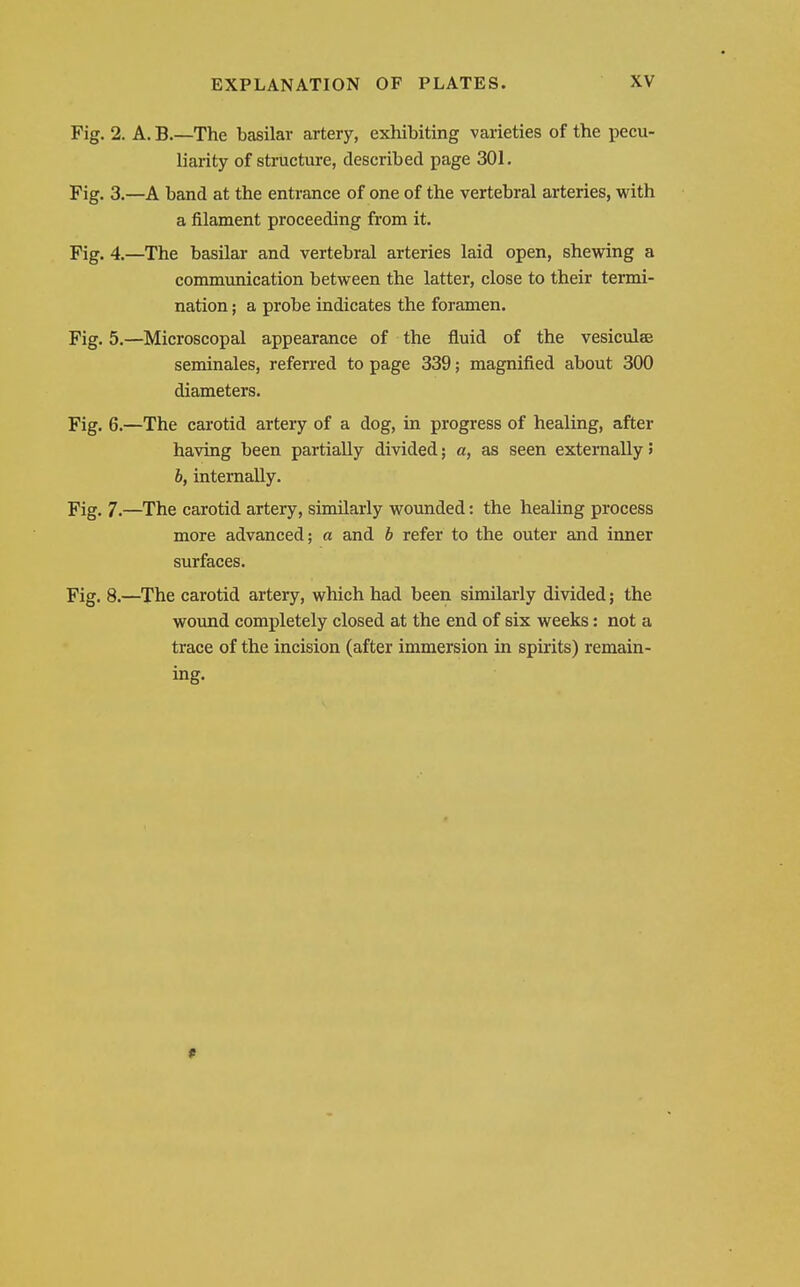 Fig. 2. A. B.—The basilar artery, exhibiting varieties of the i)ecu- liarity of structure, described page 301. Fig. 3.—A band at the entrance of one of the vertebral arteries, with a filament proceeding from it. Fig. 4.—The basilar and vertebral arteries laid open, shewing a communication between the latter, close to their termi- nation ; a probe indicates the foramen. Fig. 5.—Microscopal appearance of the fluid of the vesiculse seminales, referred to page 339; magnified about 300 diameters. Fig. 6.—The carotid artery of a dog, in progress of healing, after having been partially divided; a, as seen externally 5 h, internally. Fig. 7.—The carotid artery, similarly wounded: the healing process more advanced; a and b refer to the outer and inner surfaces. Fig. 8.—The carotid artery, which had been similarly divided; the wound completely closed at the end of six weeks: not a trace of the incision (after immersion in spirits) remain- ing. 9