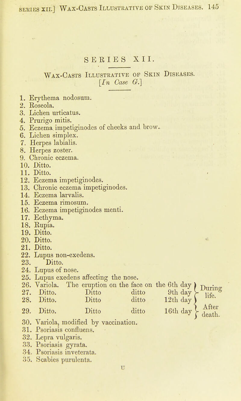 SERIES XII. Wax-Casts Illustrative of Skin Diseases. [In Case G.] 1. Erythema nodosum. 2. Roseola. 3. Lichen urticatus. 4. Prurigo mitis. 5. Eczema, impetiginodes of cheeks and brow. 6. Lichen simplex. 7. Herpes labialis. 8. Herpes zoster. 9. Chronic eczema. 10. Ditto. 11. Ditto. 12. Eczema impetiginodes. 13. Chronic eczema impetiginodes. 14. Eczema larvalis. 15. Eczema rimosum. 16. Eczema impetiginodes menti. 17. Ecthyma. 18. Rupia. 19. Ditto. 20. Ditto. 21. Ditto. 22. Lupus non-exedens. 23. Ditto. 24. Lupus of nose. 25. Lupus exedens affecting the nose. 26. Variola. The eruption on the face on the 6th day ) T),,^;r,p- 27. Ditto. Ditto ditto 9th day V- 28. Ditto. Ditto ditto 12th day) 29. Ditto. Ditto ditto 16th day |- 30. Variola, modified by vaccination. 31. Psoriasis confluens. 32. Lepra vulgaris. 33. Psoriasis gyrata. 34. Psoriasis inveterata. 35. Scabies purulenta. U After death.