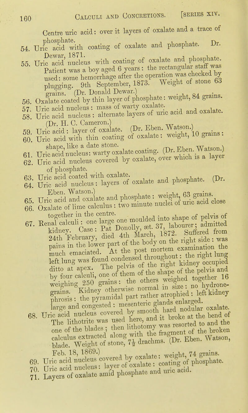 Centre uric acid: over it layers of oxalate and a trace of 54. Uri? ac^d^'witli coating of oxalate and phosphate. Dr. 55. Uric 3 nucVeus with coating of oxalate and phosphate Patient was a boy aged 6 years : the rectangular staff was usersore hemorrhage after the operation was checked hy plugging. 9th September, 1873. Weight of stone 63 P-rains (Dr. Donald Dewar.) . , , o ^ 56. OxaTte Ited by thin layer of phosphate: weight, 84 grams. 57. Uric acid nucleus : mass of warty oxalate. oxalate 58. Uric acid nucleus : alternate layers of uric acid and oxalate. (Dr. H. C. Cameron.) -^r ^ \ shape, like a date stone. Watson ) 61. Uric acid nucleus: warty oxalate coating, (^^'^i^-.™ 62. Uric acid nucleus covered by oxalate, over which is a layer of phosphate. S-r^iarotr-U:^-oxalate and phosphate. (D. kidney Case: i87? Suffered from 24th February, ''''='1 „ the riglit side: was pains in the ower P-^-^^ postlC^^^^ the ['iTand con'gLted : 'tof ll^dlTut oxalate. 68. Urieacid nucleus l:„S\ iTar ft