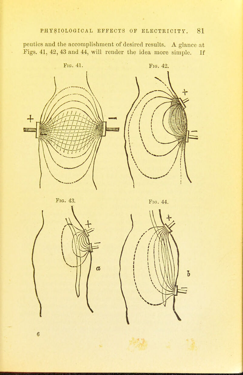 peutics aud the accomplishment of desired results. A glance at Figs. 41, 42, 43 and 44, will render the idea more simple. If Fig. 41. Fig. 42.