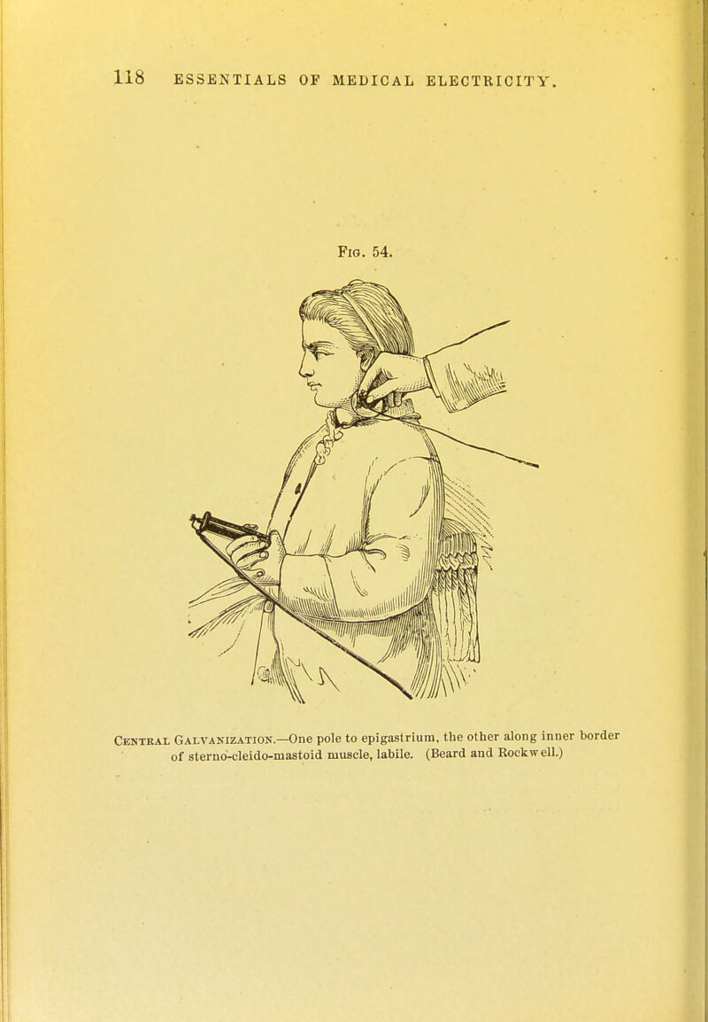 Fig. 54. Central Galvanization—One pole to epigastrium, the other along inner border of sterno-cleido-niastoid muscle, labile. (Beard and Rockwell.)