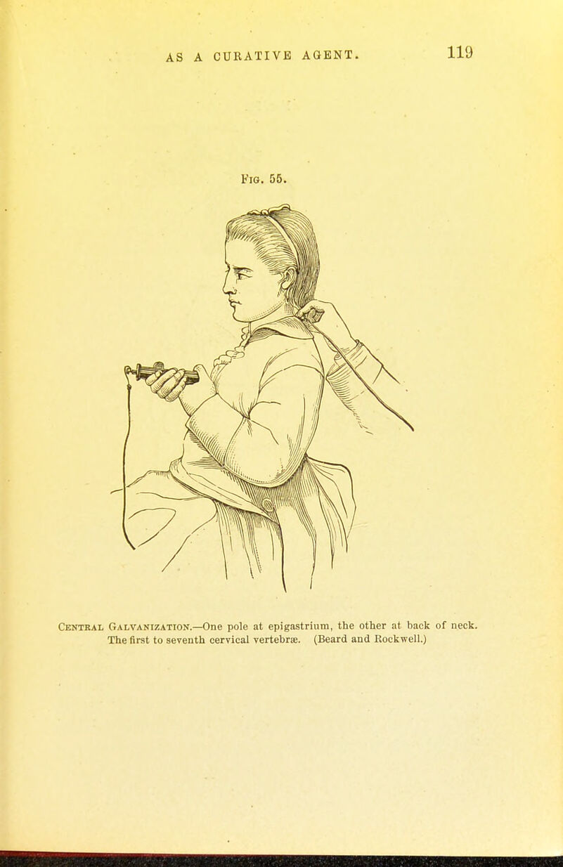 Central Galvanization.—One pole at epigastrium, the other at back of neck. The first to seventh cervical vertebrae. (Beard and Rockwell.)