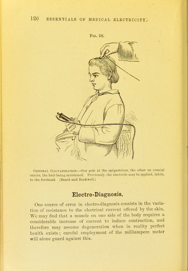 Fig. 56. General Galvanization.—One pole at the epigastrium, the other on cranial centre, the hair being moistened. Previously, the electrode may be applied, labile, to the forehead. (Beard and Rockwell.) Electro -Diagno sis, One source of error in electro-diagnosis consists in the varia- tion of resistance to the electrical current offered by the skin. We may find that a muscle on one side of the body requires a considerable increase of current to induce contraction, and therefore may assume degeneration when in reality perfect health exists; careful employment of the milliampere meter will alone guard against this.