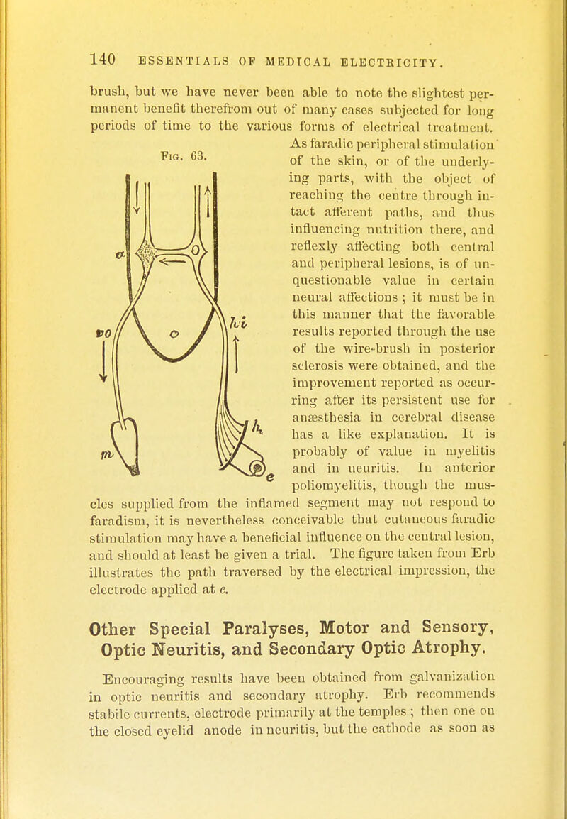 Fig. 63. t>0 brush, but we have never been able to note the slightest per- manent benefit therefrom out of many cases subjected for long periods of time to the various forms of electrical treatment. As faradic peripheral stimulation of the skin, or of the underly- ing parts, with the object of reaching the centre through in- tact afferent paths, and thus influencing nutrition there, and reflexly affecting both central and peripheral lesions, is of un- questionable value in certain neural affections ; it must be in this manner that the favorable results reported through the use I JJ ^^^/^ °f ^ue wire-brush in posterior sclerosis were obtained, and the improvement reported as occur- ring after its persistent use fur anaesthesia in cerebral disease has a like explanation. It is probably of value in myelitis and in neuritis. In anterior poliomyelitis, though the mus- cles supplied from the inflamed segment may not respond to faradism, it is nevertheless conceivable that cutaneous faradic stimulation may have a beneficial influence on the central lesion, and should at least be given a trial. The figure taken from Erb illustrates the path traversed by the electrical impression, the electrode applied at e. Other Special Paralyses, Motor and Sensory, Optic Neuritis, and Secondary Optic Atrophy. Encouraging results have been obtained from galvanization in optic neuritis and secondary atrophy. Erb recommends stabile currents, electrode primarily at the temples ; then one on the closed eyelid anode in neuritis, but the cathode as soon as