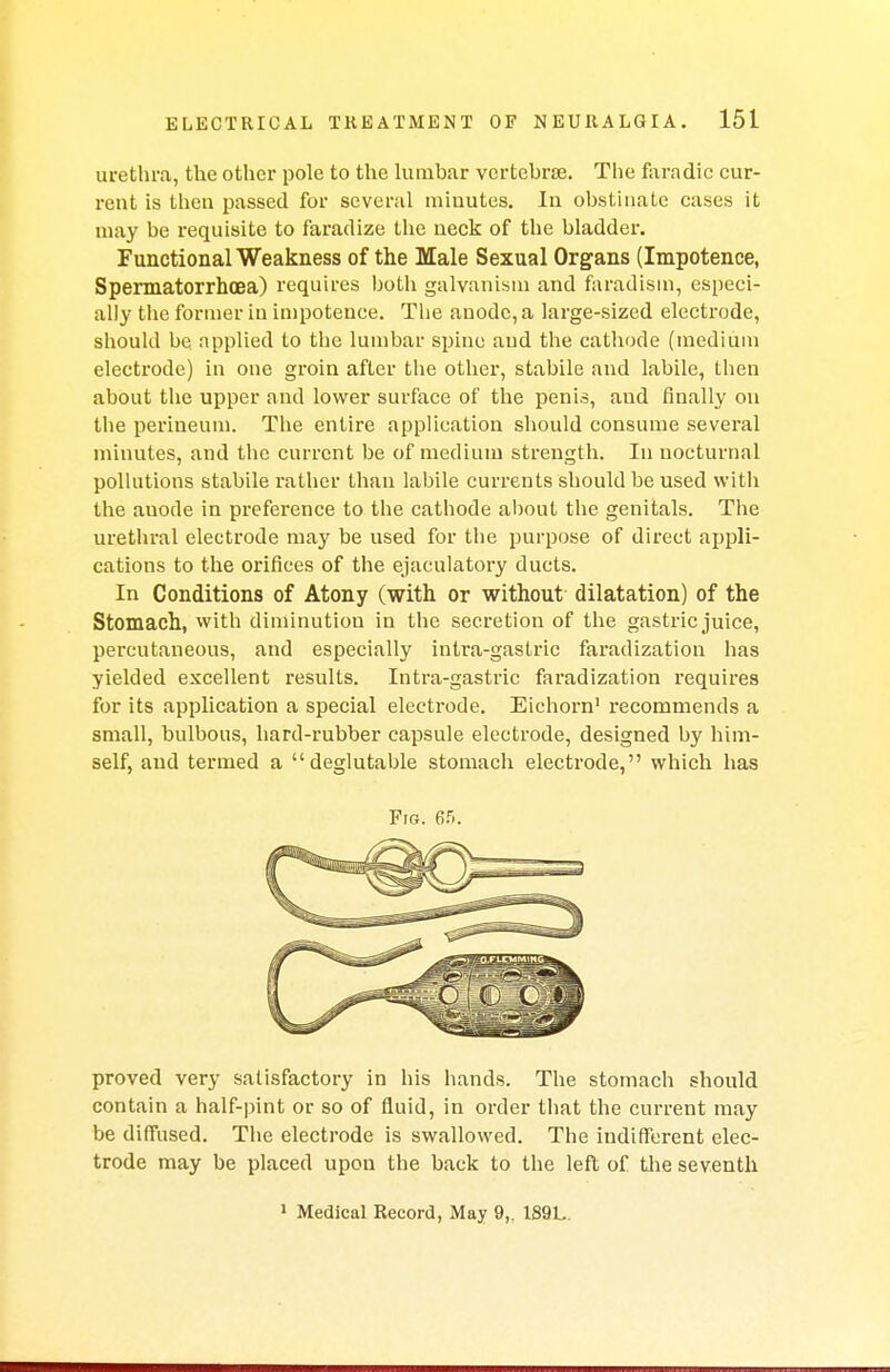 urethra, the other pole to the lumbar vertebrae. The fhradic cur- rent is then passed for several minutes. In obstinate cases it may be requisite to faradize the neck of the bladder. Functional Weakness of the Male Sexual Organs (Impotence, Spermatorrhoea) requires both galvanism and faradisin, especi- ally the former in impotence. The anode, a large-sized electrode, should be. applied to the lumbar spine and the cathode (medium electrode) in one groin after the other, stabile and labile, then about the upper and lower surface of the penis, aud finally on the perineum. The entire application should consume several minutes, and the current be of medium strength. In nocturnal pollutions stabile rather than labile currents should be used with the auode in preference to the cathode about the genitals. The urethral electrode may be used for the purpose of direct appli- cations to the orifices of the ejaculatory ducts. In Conditions of Atony (with or without dilatation) of the Stomach, with diminution in the secretion of the gastric juice, percutaneous, and especially intra-gastric faradization has yielded excellent results. Intra-gastric faradization requires for its application a special electrode. Eichorn1 recommends a small, bulbous, hard-rubber capsule electrode, designed by him- self, and termed a deglutable stomach electrode, which has proved very satisfactory in his hands. The stomach should contain a half-pint or so of fluid, in order that the current may be diffused. The electrode is swallowed. The indifferent elec- trode may be placed upon the back to the left of the seventh Fig. 6f». 1 Medical Record, May 9,. 189L.