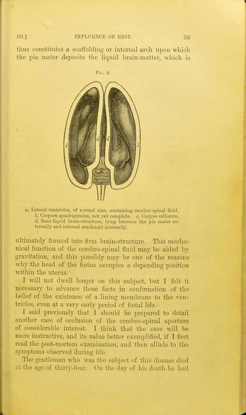 thus constitutes a scaffolding or internal arch upon which the pia mater deposits the liquid brain-matter, which is Fig. 8. «, Lateral ventricles, of normal size, containing cerebro-spinal fluid. b, Corpora quadrigemina, not yet complete, c, Coipus callosum. d, Semi-liquid brain-structure, lying between the pia mater ex- ternally and internal arachnoid internally. ultimately formed into firm brain-structure. This mecha- nical function of the cerebro-spinal fluid may be aided by gravitation, and this possibly may be one of the reasons why the head of the foetus occupies a depending position within the uterus.' I will not dwell longer on this subject, but I felt it necessary to advance these facts in confirmation of the belief of the existence of a lining membrane to the ven- tricles, even at a very early period of foetal life. I said previously that I should be prepared to detail . another case of occlusion of the cerebro-spinal aperture of considerable interest. I think that the case will be more instructive, and its value better exemplified, if I first read the post-mortem examination, and then allude to the symptoms observed during life. The gentleman who was the subject of this disease died at the age of thirty-four. On the day of his death he hail