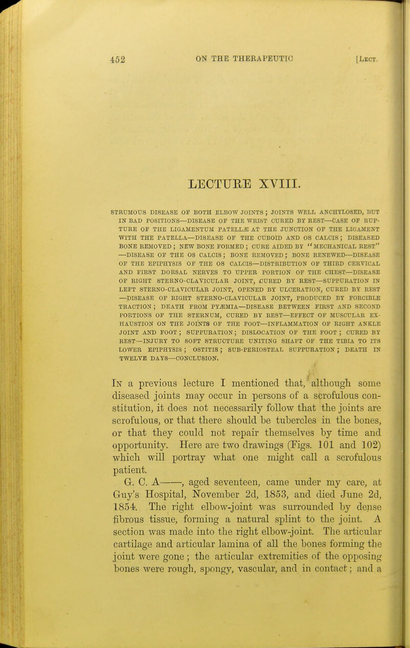 LECTURE XVIII. STRUMOUS DISEASE OF BOTH ELBOW JOINTS ; JOINTS WELL ANCHYLOSES, BUT IN BAD POSITIONS—DISEASE OF THE WRIST CURED BY REST—CASE OF RUP- TURE OF THE LIGAMENTUM PATELLiE AT THE JUNCTION OF THE LIGAMENT WITH THE PATELLA—DISEASE OF THE CUBOID AND OS CALCIS ; DISEASED BONE REMOVED ; NEW BONE FORMED ; CURE AIDED BY MECHANICAL BEST —DISEASE OF THE OS CALCIS; BONE REMOVED J BONE RENEWED—DISEASE OF THE EPIPHYSIS OF THE OS CALCIS—DISTRIBUTION OF THIRD CERVICAL AND FIRST DORSAL NERVES TO UPPER PORTION OF THE CHEST—DISEASE OF RIGHT STERNO-CLAVICULAR JOINT, CURED BY REST—SUPPURATION IN LEFT STERNO-CLAVICULAR JOINT, OPENED BY ULCERATION, CURED BY REST —DISEASE OF RIGHT STERNO-CLAVICULAR JOINT, PRODUCED BY FORCD3LE TRACTION ; DEATH FROM PYEMIA—DISEASE BETWEEN FIRST AND SECOND PORTIONS OF THE STERNUM, CURED BY REST—EFFECT OF MUSCULAR EX- HAUSTION ON THE JOINTS OF THE FOOT—INFLAMMATION OF RIGHT ANKLE JOINT AND FOOT ; SUPPURATION; DISLOCATION OF THE FOOT ; CURED BY REST—INJURY TO SOFT STRUCTURE UNITING SHAFT OF THE TIBIA TO ITS LOWER EPIPHYSIS ; OSTITIS ; SUB-PERIOSTEAL SUPPURATION ; DEATH IN TWELVE DAYS—CONCLUSION. In a previous lecture I mentioued that, although some diseased joints may occur in persons of a scrofulous con- stitution, it does not necessarily follow that the joints are scrofulous, or that there should be tubercles in the bones, or that they could not repair themselves by time and opportunity. Here are two drawings (Figs. 101 and 102) which will portray what one might call a scrofulous patient. G. C. A , aged seventeen, came under my care, at Guy's Hospital, November 2d, 1853, and died June 2d, 1854. The right elbow-joint was surrounded by dense fibrous tissue, forming a natural splint to the joint. A section was made into the right elbow-joint. The articular cartilage and articular lamina of all the bones forming the joint were gone; the articular extremities of the opposing bones were rough, spongy, vascular, and in contact; and a