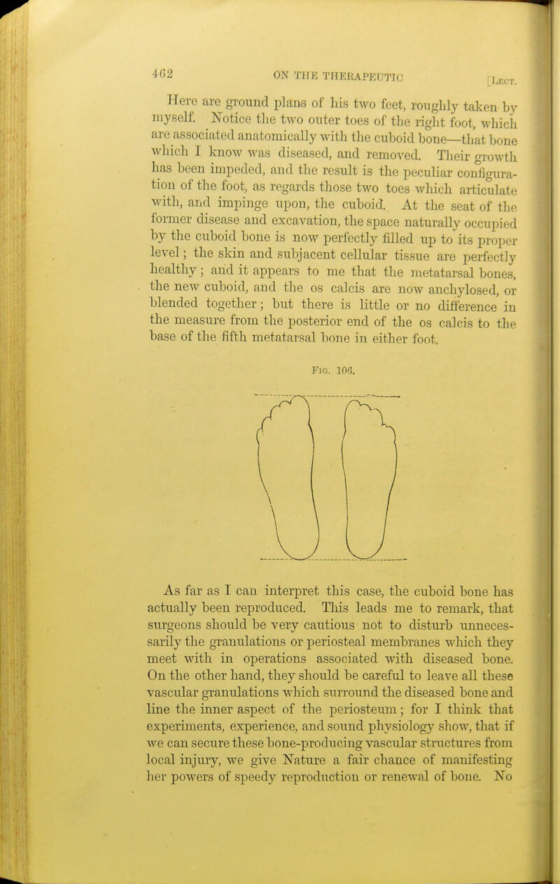 [Eect. Here are ground plans of his two feet, roughly taken by myself. Notice the two outer toes of the right foot, which are associated anatomically with the cuboid bone—that bone which I know was diseased, and removed. Their growth has been impeded, and the result is the peculiar configura- tion of the foot, as regards those two toes which articulate with, and impinge upon, the cuboid. At the seat of the former disease and excavation, the space naturally occupied by the cuboid bone is now perfectly filled up to its proper level; the skin and subjacent cellular tissue are perfectly healthy; and it appears to me that the metatarsal bones, the new cuboid, and the os calcis are now anchylosed, or blended together; but there is little or no difference in the measure from the posterior end of the os calcis to the base of the fifth metatarsal bone in either foot. As far as I can interpret this case, the cuboid bone has actually been reproduced. This leads me to remark, that surgeons should be very cautious not to disturb unneces- sarily the granulations or periosteal membranes winch they meet with in operations associated with diseased bone. On the other hand, they should be careful to leave all these vascular granulations which surround the diseased bone and line the inner aspect of the periosteum; for I think that experiments, experience, and sound physiology show, that if we can secure these bone-producing vascular structures from local injury, we give Nature a fair chance of manifesting her powers of speedy reproduction or renewal of bone. No Fig. 10<5.