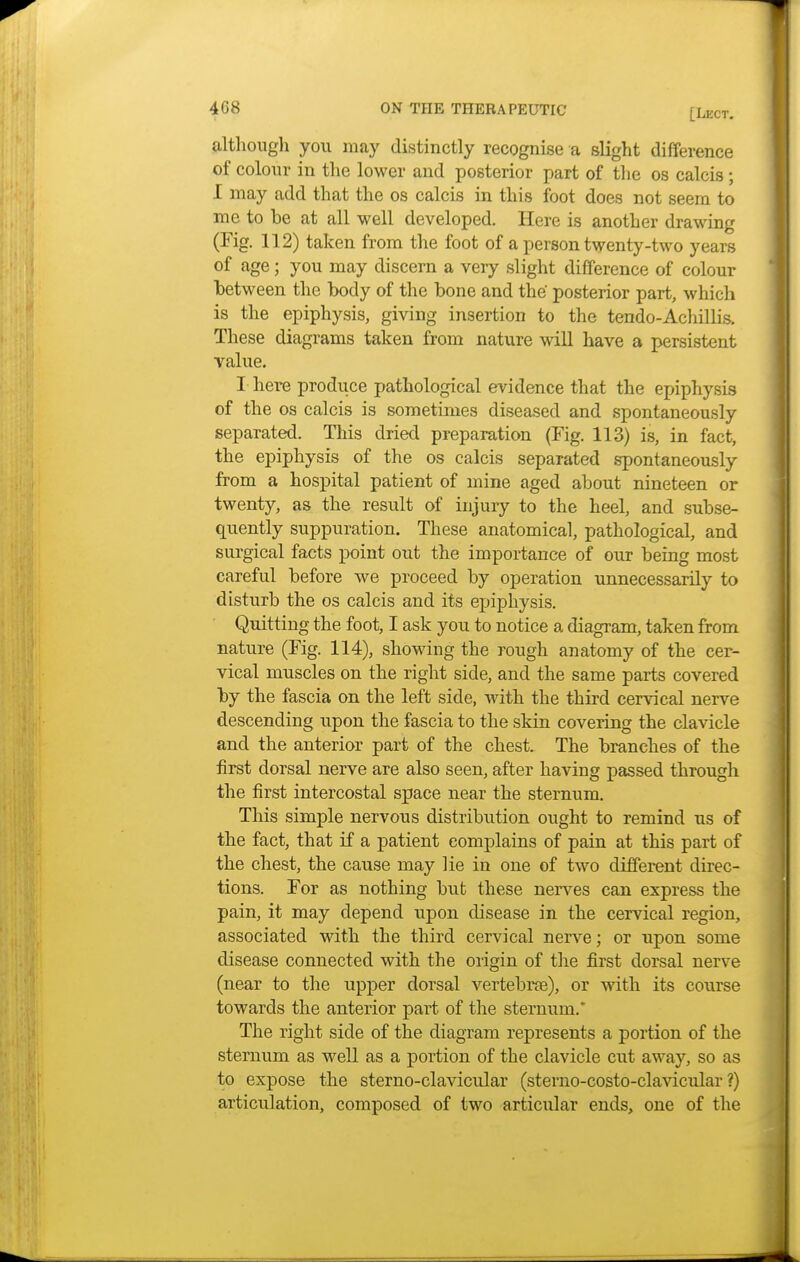 although you may distinctly recognise a slight difference of colour in the lower and posterior part of the os calcis; I may add that the os calcis in this foot does not seem to me to be at all well developed. Here is another drawing (Fig. 112) taken from the foot of a person twenty-two years of age; you may discern a very slight difference of colour between the body of the bone and the posterior part, which is the epiphysis, giving insertion to the tendo-Achillis. These diagrams taken from nature will have a persistent value. I here produce pathological evidence that the epiphysis of the os calcis is sometimes diseased and spontaneously separated. This dried preparation (Fig. 113) is, in fact, the epiphysis of the os calcis separated spontaneously from a hospital patient of mine aged about nineteen or twenty, as the result of injury to the heel, and subse- quently suppuration. These anatomical, pathological, and surgical facts point out the importance of our being most careful before we proceed by operation unnecessarily to disturb the os calcis and its epiphysis. Quitting the foot, I ask you to notice a diagram, taken from nature (Fig. 114), showing the rough anatomy of the cer- vical muscles on the right side, and the same parts covered by the fascia on the left side, with the third cervical nerve descending upon the fascia to the skin covering the clavicle and the anterior part of the chest. The branches of the first dorsal nerve are also seen, after having passed through the first intercostal space near the sternum. This simple nervous distribution ought to remind us of the fact, that if a patient complains of pain at this part of the chest, the cause may lie in one of two different direc- tions. For as nothing but these nerves can express the pain, it may depend upon disease in the cervical region, associated with the third cervical nerve; or upon some disease connected with the origin of the first dorsal nerve (near to the upper dorsal vertebrce), or with its course towards the anterior part of the sternum.* The right side of the diagram represents a portion of the sternum as well as a portion of the clavicle cut away, so as to expose the sterno-clavicular (sterno-costo-clavicular ?) articulation, composed of two articular ends, one of the
