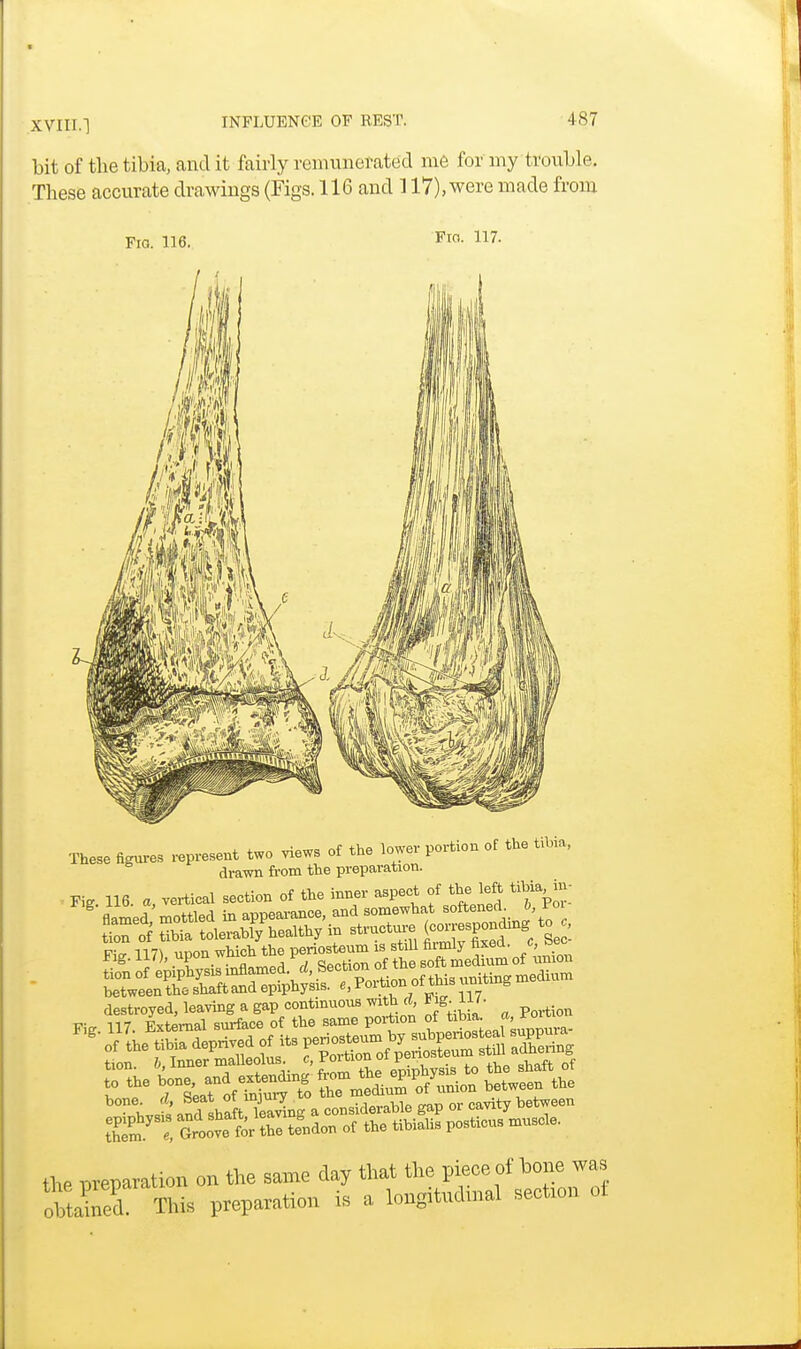 bit of the tibia, and it fairly remunerated me for my trouble. These accurate drawings (Figs. 116 and 117), were made from Fro. 116. Fro. 117. These figures represent two views of the lower portion of the tibia, drawn from the preparation. Fig. 116. a, vertical section of the inner aspect of the left tibia in- Fig. 117), upon „M0h the perform - Sl , iltt rSd<m .( the Ubidk pcticu. the preparation on the same day that the piece of hone was obtained. This preparation is a longniuhnal sect™ ot