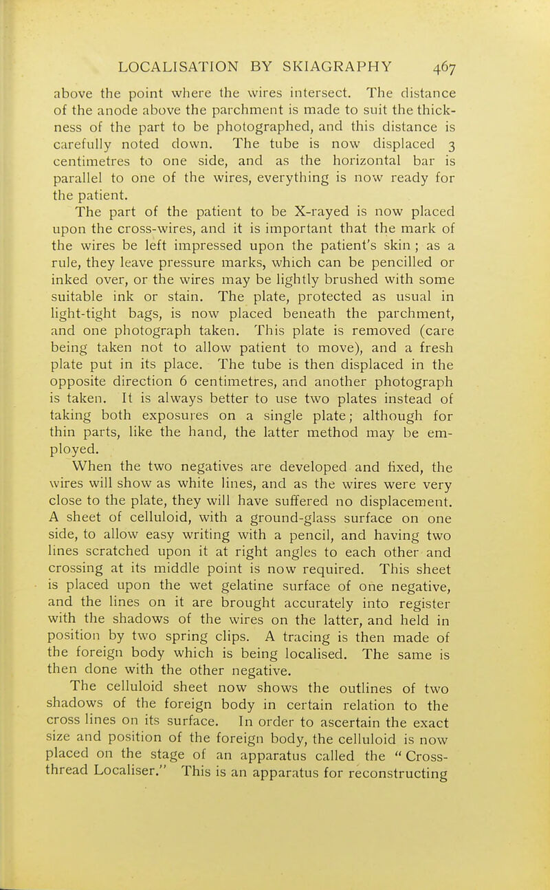 above the point where the wires intersect. The distance of the anode above the parchment is made to suit the thick- ness of the part to be photographed, and this distance is carefully noted clown. The tube is now displaced 3 centimetres to one side, and as the horizontal bar is parallel to one of the wires, everything is now ready for the patient. The part of the patient to be X-rayed is now placed upon the cross-wires, and it is important that the mark of the wires be left impressed upon the patient's skin ; as a rule, they leave pressure marks, which can be pencilled or inked over, or the wires may be lightly brushed with some suitable ink or stain. The plate, protected as usual in light-tight bags, is now placed beneath the parchment, and one photograph taken. This plate is removed (care being taken not to allow patient to move), and a fresh plate put in its place. The tube is then displaced in the opposite direction 6 centimetres, and another photograph is taken. It is always better to use two plates instead of taking both exposures on a single plate; although for thin parts, like the hand, the latter method may be em- ployed. When the two negatives are developed and fixed, the wires will show as white lines, and as the wires were very close to the plate, they will have suffered no displacement. A sheet of celluloid, with a ground-glass surface on one side, to allow easy writing with a pencil, and having two lines scratched upon it at right angles to each other and crossing at its middle point is now required. This sheet is placed upon the wet gelatine surface of one negative, and the lines on it are brought accurately into register with the shadows of the wires on the latter, and held in position by two spring clips. A tracing is then made of the foreign body which is being localised. The same is then done with the other negative. The celluloid sheet now shows the outlines of two shadows of the foreign body in certain relation to the cross lines on its surface. In order to ascertain the exact size and position of the foreign body, the celluloid is now placed on the stage of an apparatus called the Cross- thread Localiser. This is an apparatus for reconstructing