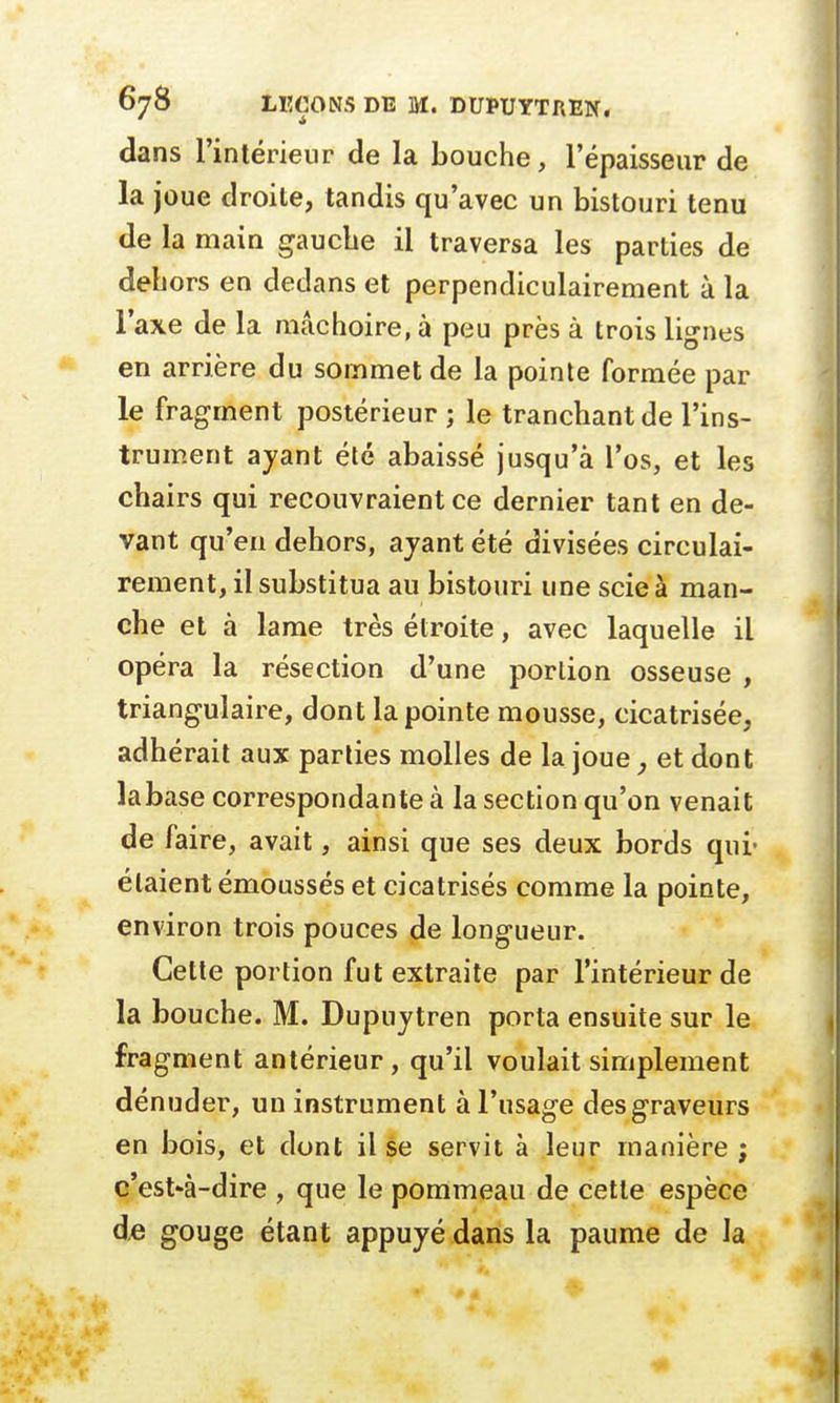 dans l'intérieur de la bouche, l'épaisseur de la joue droite, tandis qu'avec un bistouri tenu de la main gauche il traversa les parties de dehors en dedans et perpendiculairement à la l'axe de la mâchoire, à peu près à trois lignes en arrière du sommet de la pointe formée par le fragment postérieur ; le tranchant de l'ins- trument ayant été abaissé jusqu'à l'os, et les chairs qui recouvraient ce dernier tant en de- vant qu'en dehors, ayant été divisées circulai- rement, il substitua au bistouri une scie à man- che et à lame très étroite, avec laquelle il opéra la résection d'une portion osseuse , triangulaire, dont la pointe mousse, cicatrisée, adhérait aux parties molles de la joue, et dont labase correspondante à la section qu'on venait de faire, avait, ainsi que ses deux bords qui- étaient émoussés et cicatrisés comme la pointe, environ trois pouces de longueur. Cette portion fut extraite par l'intérieur de la bouche. M. Dupuytren porta ensuite sur le fragment antérieur, qu'il voulait simplement dénuder, un instrument à l'usage des graveurs en bois, et dont il se servit à leur manière ; c'est*à-dire , que le pommeau de cette espèce de gouge étant appuyé dans la paume de la