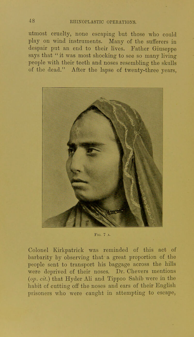 utmost cruelty, none escaping but those who could play on wind instruments. Many of the sufferers in despair put an end to their lives. Father Giuseppe says that  it was most shocking to see so many living people with their teeth and noses resembling the skulls of the dead. After the lapse of twenty-three years, Fig. 7 a. Colonel Kirkpatrick was reminded of this act of barbarity by observing that'a great proportion of the people sent to transport his baggage across the hills were deprived of their noses. Dr. Chevers mentions {op. cit.) that Hyder Ali and Tippoo Sahib were in the habit of cutting off the noses and ears of their English prisoners who were caught in attempting to escape.