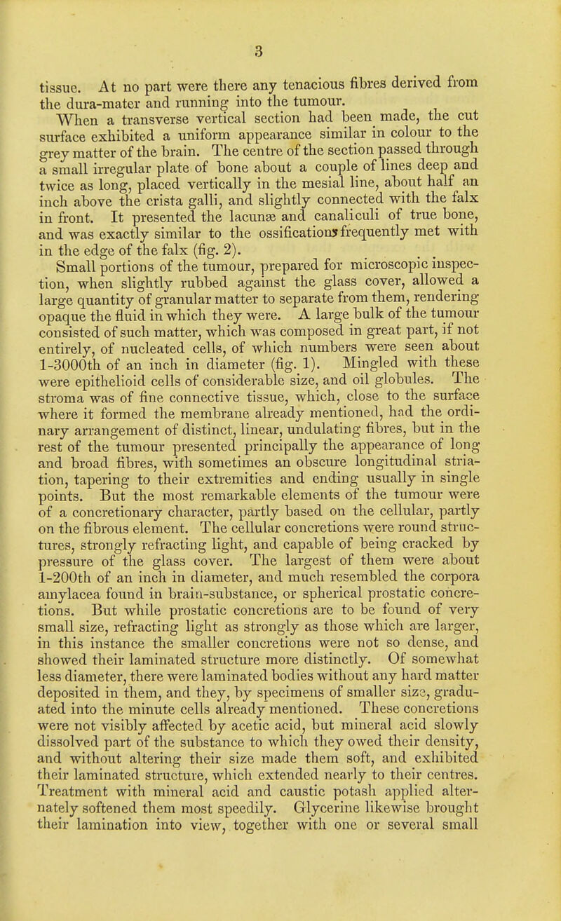 tissue. At no part were there any tenacious fibres derived from the dura-mater and running into the tumour. When a transverse vertical section had been^ made, the cut surface exhibited a uniform appearance similar in colour to the grey matter of the brain. The centre of the section passed through a small irregular plate of bone about a couple of lines deep and twice as long, placed vertically in the mesial line, about half an inch above the crista galli, and slightly connected with the falx in front. It presented the lacunse and canaliculi of true bone, and was exactly similar to the ossification* frequently met with in the edge of the falx (fig. 2). Small portions of the tumour, prepared for microscopic inspec- tion, when slightly rubbed against the glass cover, allowed a large quantity of granular matter to separate from them, rendering opaque the fluid in which they were. A large bulk of the tumour consisted of such matter, which was composed in great part, if not entirely, of nucleated cells, of which numbers were seen about l-3000th of an inch in diameter (fig. 1). Mingled with these were epithelioid cells of considerable size, and oil globules. The stroma was of fine connective tissue, which, close to the surface where it formed the membrane already mentioned, had the ordi- nary arrangement of distinct, linear, undulating fibres, but in the rest of the tumour presented principally the appearance of long and broad fibres, with sometimes an obscure longitudinal stria- tion, tapering to their extremities and ending usually in single points. But the most remarkable elements of the tumour were of a concretionary character, partly based on the cellular, partly on the fibrous element. The cellular concretions were round struc- tures, strongly refracting light, and capable of being cracked by pressure of the glass cover. The largest of them were about l-200th of an inch in diameter, and much resembled the corpora amylacea found in brain-substance, or spherical prostatic concre- tions. But while prostatic concretions are to be found of very small size, refracting light as strongly as those which are larger, in this instance the smaller concretions were not so dense, and showed their laminated structure more distinctly. Of somewhat less diameter, there were laminated bodies without any hard matter deposited in them, and they, by specimens of smaller size, gradu- ated into the minute cells already mentioned. These concretions were not visibly affected by acetic acid, but mineral acid slowly dissolved part of the substance to which they owed their density, and without altering their size made them soft, and exhibited their laminated structure, which extended nearly to their centres. Treatment with mineral acid and caustic potash applied alter- nately softened them most speedily. Glycerine likewise brought their lamination into view, together with one or several small