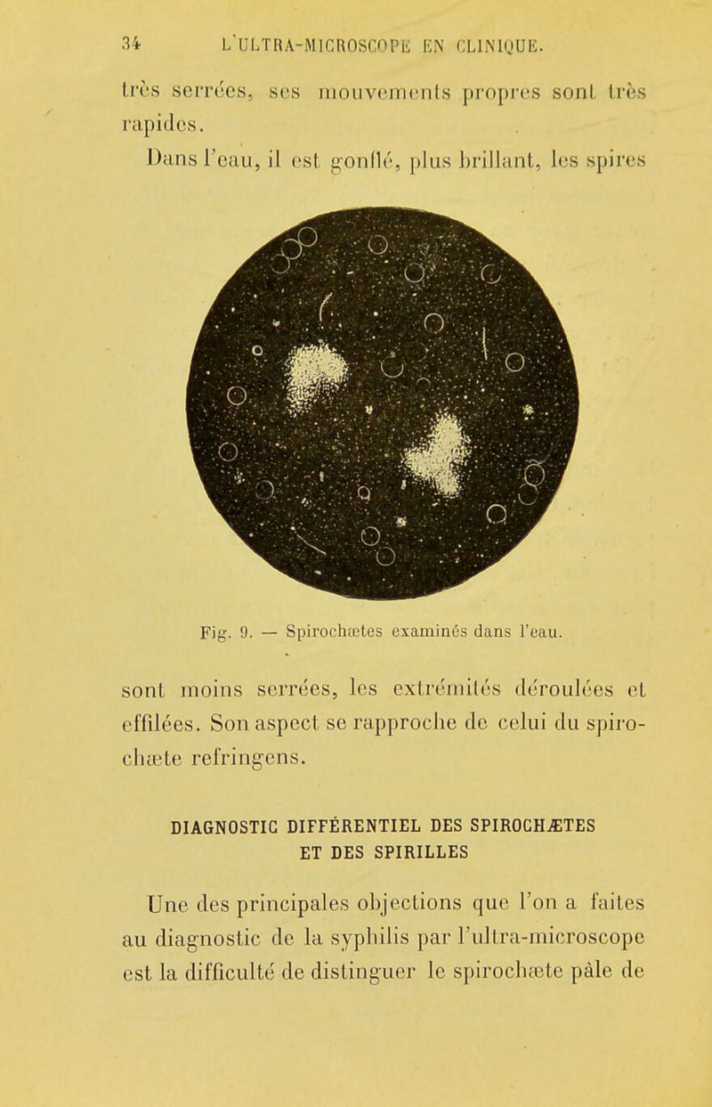 Irùs serrées, ses iiiouvemcnts propres sont très rapides. Dans l'eau, il est g-onflé, plus brillant, les spires Fig. 9. — Spirochœtes examinés dans l'eau. sont moins serrées, les extrémités déroulées et effilées. Son aspect se rapproche de celui du spiro- chtete refringens. DIAGNOSTIC DIFFÉRENTIEL DES SPIROCHŒTES ET DES SPIRILLES Une des principales objections que l'on a faites au diagnostic de la syphilis par l'ultra-microscope est la difficulté de distinguer le spirochfete paie de