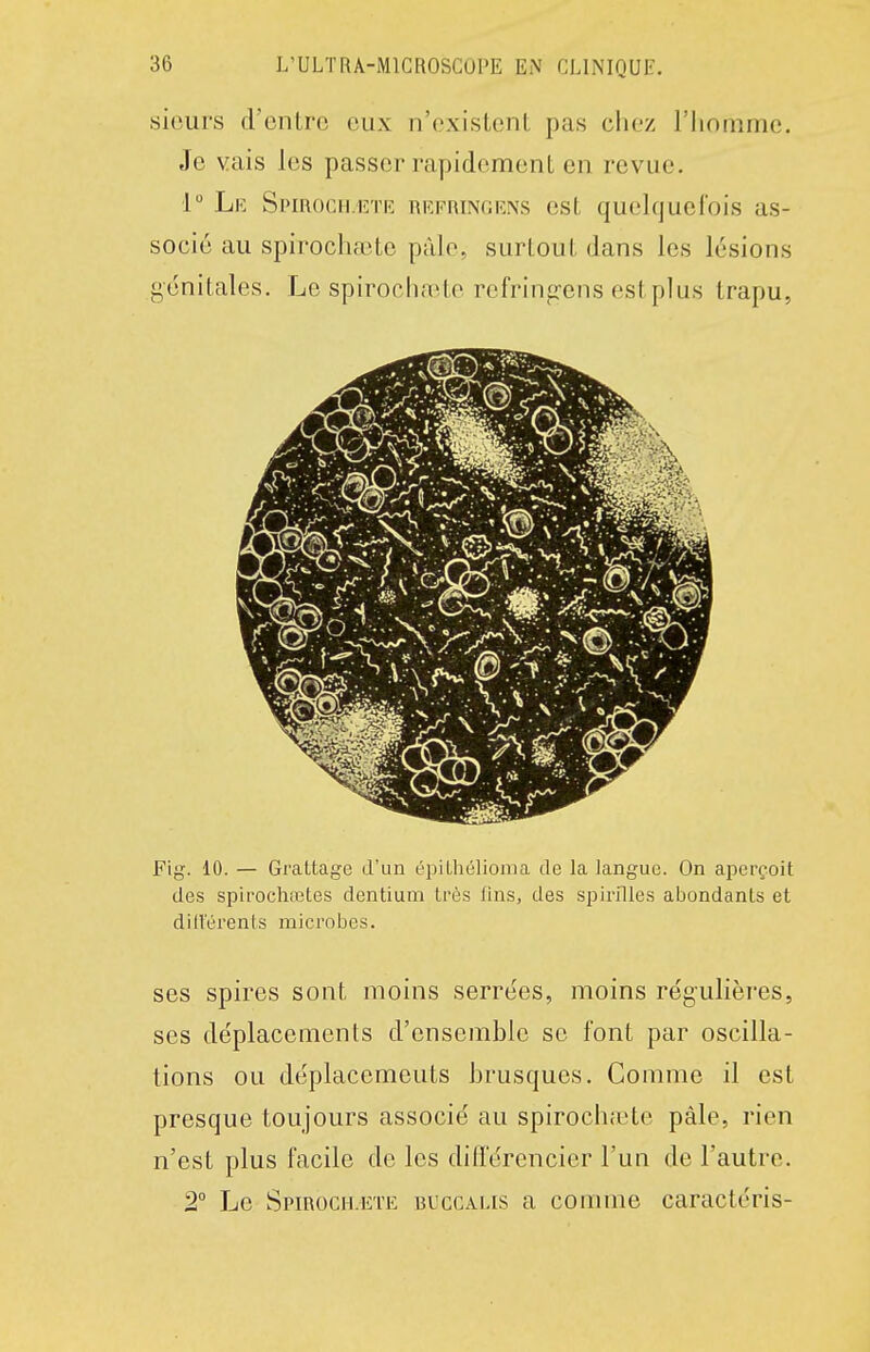 siours d'entre eux n'existent pas chez l'homme. Je vais les passer rapidement en revue. 1° Lk SpmocH.iîTE RiîFniNr.iîNs est quelquefois as- socié au spirochaîte pâle, surtout dans les lésions génitales. Le spirochaîte refring'ens estplus trapu. Fig. 10. — Grattage d'un épiLhélioma de la langue. On aperçoit des spirochœtes dentium lrè.s fins, des spirilles abondants et diilerents microbes. ses spires sont moins serrées, moins régulières, ses déplacements d'ensemble se font par oscilla- tions ou déplacemeuts brusques. Comme il est presque toujours associé au spiroch;ete pâle, rien n'est plus facile de les différencier l'un de l'autre. 2° Le SpmocH.ETE bucgalis a connue caractéris-