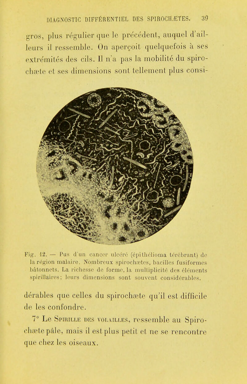 gros, plus végiilier que le précédent,, auquel d'ail- leurs il ressemble. On aperçoit quelquefois à ses extre'mités des cils. Il n'a pas la mobilité du spiro- chœte et ses dimensions sont tellement plus consi- Fig. 12. — Pus d'un cancer ulcéré (éi)ilhclioma térébrant) dn la région malaire. Nombreux spirochrctcs, bacilles fusil'ormcs bâtonnets. La richesse do forme, la inulliplicité des éléiuents spirillaires ; leurs dimensions sont souvent considérables. dérables que celles du spirochœte qu'il est difficile de les confondre. 7° Le Spirille des volailles, ressemble au Spiro- chœtepâle, mais il est plus petit et ne se rencontre que chez les oiseaux.