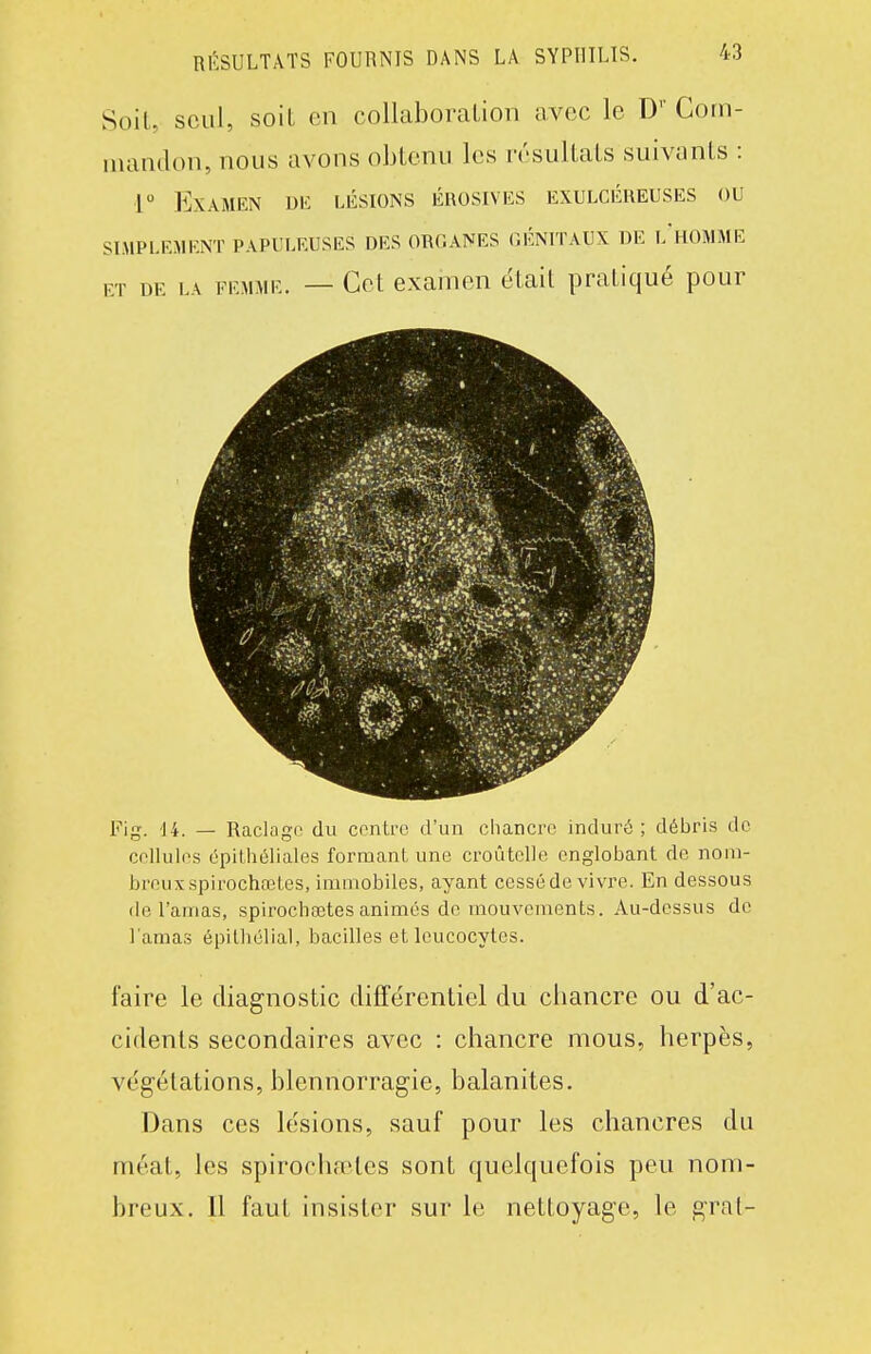 Soil, seul, soiL en collaboraLion avec le D'' Coin- iiiandoii, nous avons obtenu les résultats suivants : 1° Examen dk lésions érosives exulcéreuses ou SLMPLEMENT PAPULRUSES DES ORGANES GÉNITAUX DE i/hOMME ET DE LA FEMME. — Cet exaiTien était pratiqué pour Fig. 14. — Raclage du centre d'un chancre induré ; débris de cellules cpilhéliales forraanl une croûtelle englobant de nom- breux spirochaBles, immobiles, ayant cessé de vivre. En dessous de l'amas, spirochœtes animés de mouvements. Au-dessus de l'amas épilhélial, bacilles et leucocytes. faire le diagnostic difTérentiel du ciiancre ou d'ac- cidents secondaires avec : chancre mous, herpès, végétations, blennorragie, balanites. Dans ces lésions, sauf pour les chancres du méat, les spirochaîles sont quelquefois peu nom- breux. Il faut insister sur le nettoyage, le grat-