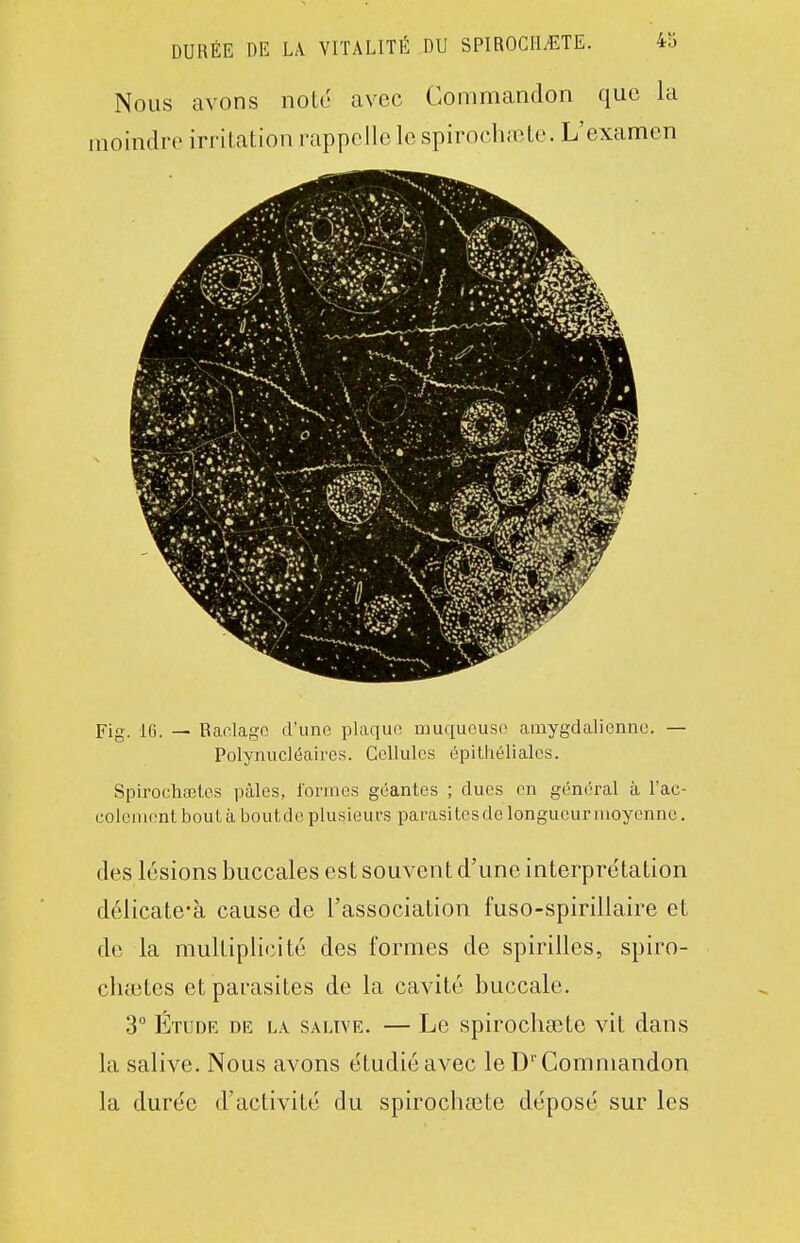 DURÉE DE LA VITALITÉ DU SPIROCH^TE. 43 Nous avons noté avec Commandon que la moindre irritation rappoIlclespirochfete.L'exanien Fig. 16. — Raclage d'une plaque muqueuse amygdalicnne. — Polynucléaires. Cellules épithéliales. Spirochaelcs pâles, l'ornies géantes ; dues en général à l'ac- eolenientboutàboutdc plusieurs parasites de longueur moyenne. des lésions buccales est souvent d'une interprétation délicate'à cause de l'association fuso-spirillaire et de la multiplicité des formes de spirilles, spiro- cluetes et parasites de la cavité buccale. 3° Étude de la sauve. — Le spirocbsete vit dans la salive. Nous avons étudié avec le D Commandon la durée d'activité du spirochsete déposé sur les