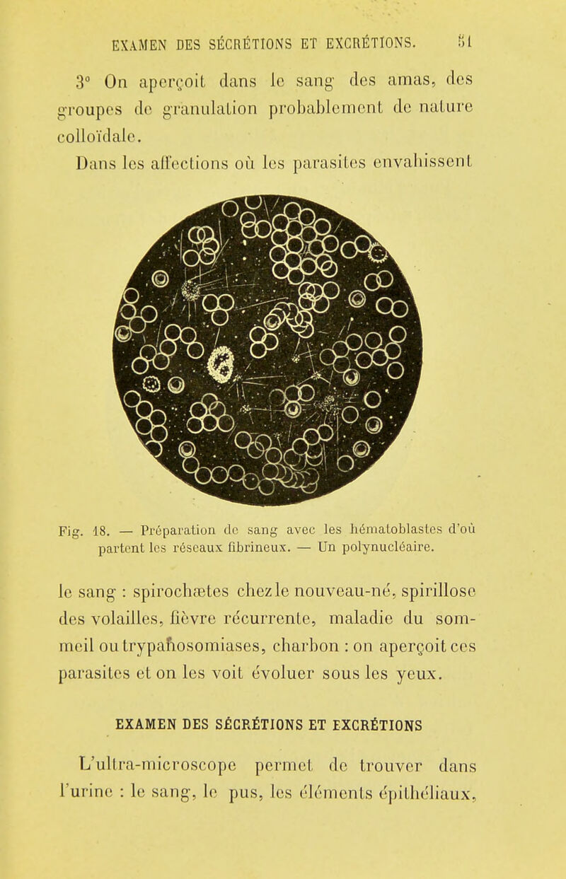 3° On aperçoit dans le sang- des amas, des gTOupes de granulaLion probablement de nature colloïdale. Dans les affections où les parasites envaliissent Fig. 18, — Pi'éparation do sang avec les héniatoblastes d'où partent les réseaux fibrineux. — Un polynucléaire. le sang : spirochaîtes chez le nouveau-né, spirillose des volailles, fièvre récurrente, maladie du som- meil outrypafiosomiases, charbon : on aperçoit ces parasites et on les voit évoluer sous les yeux. EXAMEN DES SÉCRÉTIONS ET EXCRÉTIONS L'ultra-microscope permet de trouver dans l'urine : le sang, le pus, les éléments épitliéliaux,