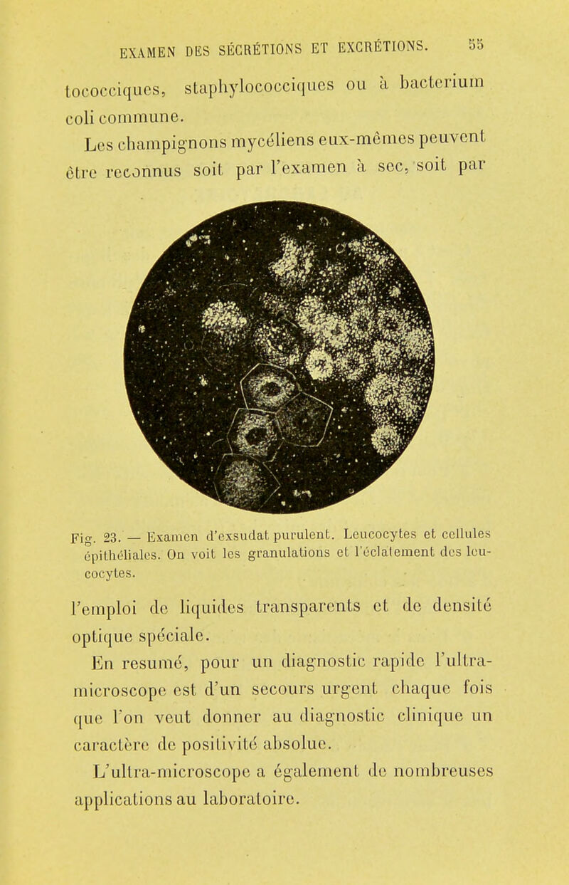 tococciques, stapliylococciqucs ou à bactcriuin coli commune. Les champignons mycéliens eux-mêmes peuvent être reconnus soit par l'examen à sec, soit par Fig. 23. — Examen d'exsudat purulent. Leucocytes et cellules épithélialcs. On voit les granulations et l'éclatement des leu- cocytes. remploi de liquides transparents et de densité optique spéciale. En résumé, pour un diagnostic rapide l'ultra- microscope est d'un secours urgent chaque fois que Ton veut donner au diagnostic clinique un caractère de positivité absolue. L'ultra-microscope a également de nombreuses applications au laboratoire.