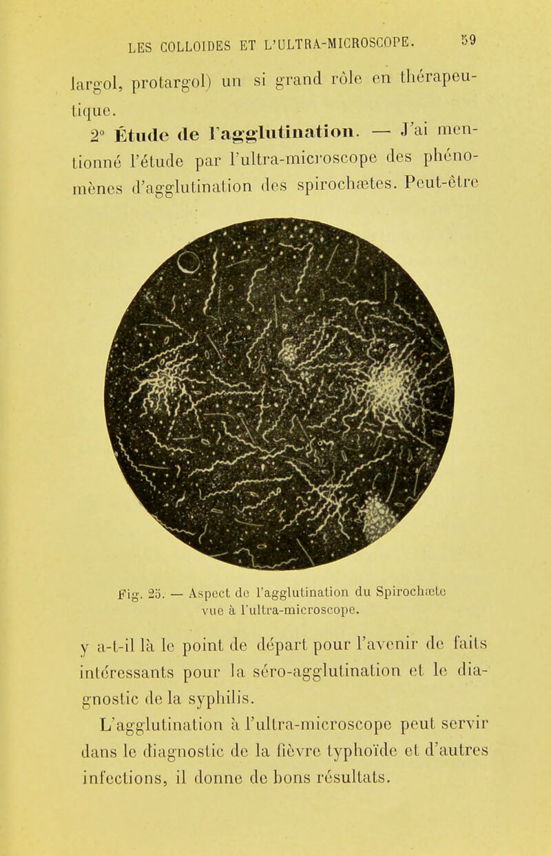 largol, protargol) un si grand rôle en thérapeu- tique. 2° Étude de ragglutinatioii. — J'ai men- tionné l'étude par l'ultra-mici-oscope des phéno- mènes d'agghitination des spirochnîtes. Peut-être Fig. 2è). — Aspect de l'agglutination du Spirochœto vue à l'ultra-mlcroscope. y a-t-il là le point de départ pour l'avenir de faits intéressants pour la séro-agg-lutination et le dia- gnostic delà syphilis. L'agglutination à l'ultra-microscope peut servir dans le diagnostic de la fièvre typhoïde et d'autres infections, il donne de hons résultats.