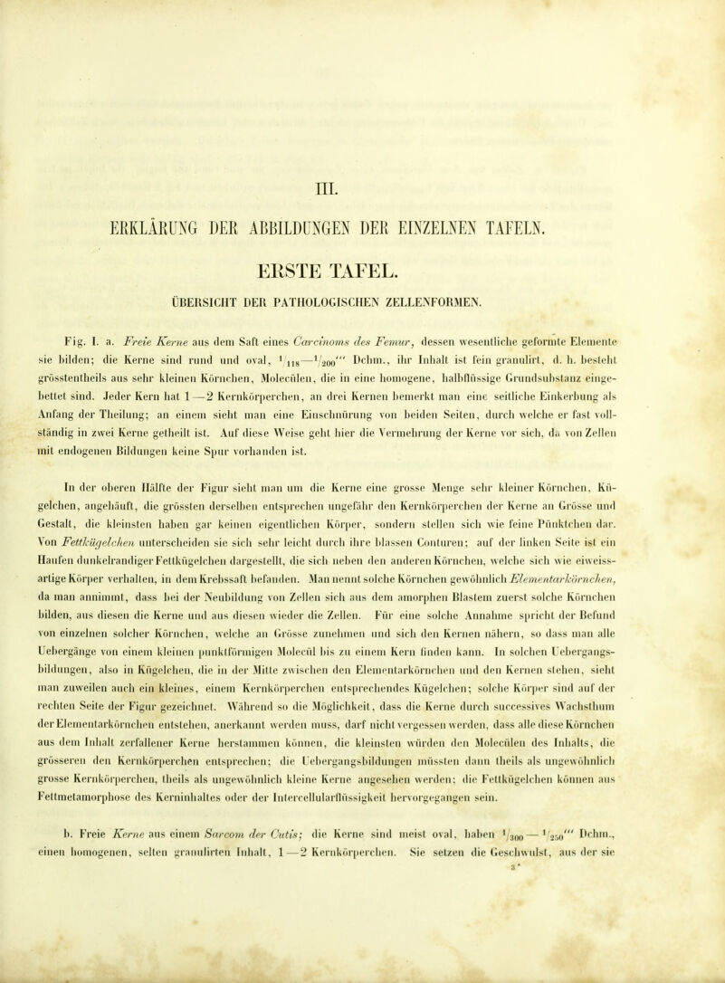 ERKLÄRUNG DER ABBILDUNGEN DER EINZELNEN TAFELN. EllSTE TAFEL. ÜBERSICHT DER PATHOLOGISCHEN ZELLENFORMEN. Fig. I. a. Freie Kerne aus dem Saft eines Carcinoms des Femur, dessen wesentliche geformte Elemente sie bilden; die Kerne sind rund und oval, 1 118—V200' Dehrn., ihr Inhalt ist fein granulirt, d. h. besteht grösstenteils aus sehr kleinen Körnehen, Molecülen, die in eine homogene, halbfliissige Grundsulistanz einge- bettet sind. Jeder Kern hat 1—2 Kernkörperchen, an drei Kernen bemerkt man eine seitliche Einkerbung als Anfang der Theilung; an einem sieht man eine Einschnürung von beiden Seiten, durch welche er fast voll- ständig in zwei Kerne getheilt ist. Auf diese Weise geht hier die Vermehrung der Kerne vor sich, d;. von Zellen mit endogenen Bildungen keine Spur vorhanden ist. In der oberen Hälfte der Figur sieht man um die Kerne eine grosse Menge sehr kleiner Körnchen, Kü- gelchen, angehäuft, die grössten derselben entsprechen ungefähr den Kernkörperchen der Kerne an Grösse und Gestalt, die kleinsten haben gar keinen eigentlichen Körper, sondern stellen sich wie feine Pünktchen dar. Von FettJcügeichen unterscheiden sie sich sehr leicht durch ihre blassen Conturen; auf der linken Seite ist ein Haufen dunkelrandigerFettkügelehen dargestellt, die sich neben den anderen Körnchen, welche sich wie eiweiss- artige Körper verhallen, in dem Krebssaft befanden. Man nennt solche Körnchen ge\\ü\\n\k\iElementarkör)tr/i<-/t, da man annimmt, dass bei der Neubildung von Zellen sich aus dem amorphen Blastem zuerst solche Körnchen bilden, aus diesen die Kerne und aus diesen wieder die Zellen. Für eine solche Annahme spricht der Befund von einzelnen solcher Körnchen, welche an Grösse zunehmen und sich den Kernen nähern, so dass man alle Uebergänge von einem kleinen punktförmigen Molecül bis zu einem Kern linden kann. In solchen Uebergangs- bildungen, also in Kügelchen, die in der Mitte zwischen den Elementarkörnchen und den Kernen stehen, sieht man zuweilen auch ein kleines, einem Kernkörperchen entsprechendes Kügelchen-, solche Körper sind auf der rechten Seite der Figur gezeichnet. Während so die Möglichkeit, dass die Kerne durch successives Waclisthiim der Elementarkörnchen entstehen, anerkannt werden muss, darf nicht vergessen werden, dass alle diese Körnchen aus dem Inhalt zerfallener Kerne herstammen können, die kleinsten würden den Molecülen des Inhalts, die grösseren den Kernkörperchen entsprechen; die Uebergangsbildungen müssten dann theils als ungewöhnlich grosse Kernkörperchen, theils als ungewöhnlich kleine Kerne angesehen werden; die Fettkügelchen können aus Fettmetamorphose des Kerninhalles oder der Intcrcellularfiüssigkeit hervorgegangen sein. b. Freie Kerne aus einem Sarcoin der Cutis; die Kerne sind meist oval, haben 1/300 —'/aso' Dehrn., einen homogenen, selten granulirten Inhalt, 1—2 Kernkörperchen. Sie setzen die Geschwulst, aus der sie 8*