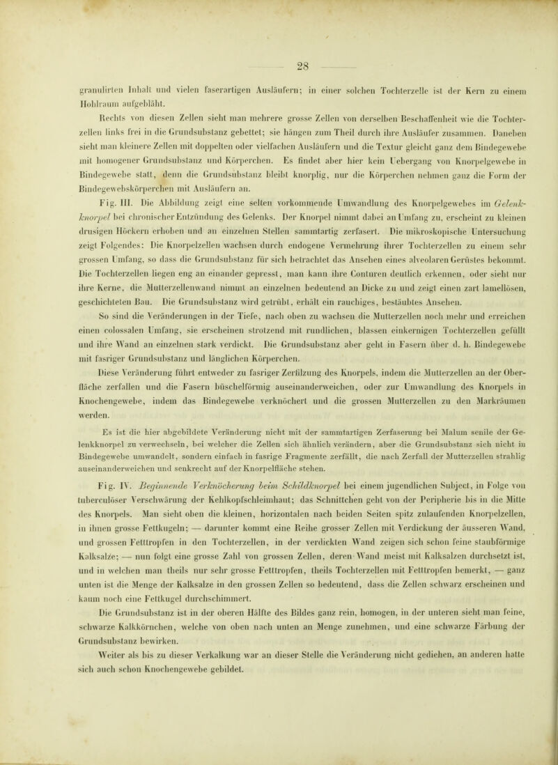 granulirleii Inhalt und vielen faserartigen Ausläufern; in einer solchen Tochterzelle ist der Kern zu einem Hohlraum aufgebläht. Rechts von diesen Zellen sieht man mehrere grosse Zellen von derselben Beschaffenheit wie die Tochter- zellen links frei in die Grundsubstanz gebettet; sie hängen zum Theil durch ihre Ausläufer zusammen. Daneben sieht man kleinere Zellen mit doppelten oder vielfachen Ausläufern und die Textur gleicht ganz dem Bindegewebe mit homogener Grundsubstanz und Körperchen. Es findet aber hier kein l ebergang von Knorpelgewebe in Bindegewebe statt, denn die Grundsubstanz bleibt knorplig, nur die Körperchen nehmen ganz die Form der Bindegewebskörpercnen mit Ausläufern an. Fig. III. Die Abbildung zeigt eine selten vorkommende Umwandlung des Knorpelgewebes im Gelenh- Jcnorpel bei chronischer Entzündung des Gelenks. Der Knorpel nimmt dabei an Umfang zu, erscheint zu kleinen drusigen Höckern erhoben und an einzelnen Stellen samintartig zerfasert. Die mikroskopische Untersuchung zeigt Folgendes: Die Knorpelzellen wachsen durch endogene Vermehrung ihrer Tochterzellen zu einem sehr grossen Umfang, so «lass die Grundsubstanz für sich betrachtet, das Ansehen eines alveolaren Gerüstes bekommt. Die Tocbterzellen liegen eng an einander gepresst, man kann ihre Conturen deutlich erkennen, oder sieht nur ihre Kerne, die Mutterzellenwand nimmt an einzelnen bedeutend an Dicke zu und zeigt einen zart lamellösen, geschichteten Bau. Die Grundsubstanz wird getrübt , erhält ein rauchiges, bestäubtes Ansehen. So sind die Veränderungen in der Tiefe, nach oben zu wachsen die Mutlerzellen noch mehr und erreichen einen colossalen Umfang, sie erscheinen strotzend mit rundlichen, blassen einkernigen Tochterzellen gefüllt und ihre Wand an einzelnen stark verdickt. Die Grundsubstanz aber gebt in Fasern über d. h. Bindegewebe mit fasriger Grundsubstanz und länglichen Körperchen. Diese Veränderung führt entweder zu fasriger Zerlilzung des Knorpels, indem die Mutterzellen an der Ober- fläche zerfallen und die Fasern büschelförmig auseinanderweichen, oder zur Umwandlung des Knorpels in Knochengewebe, indem das Bindegewebe verknöchert und die grossen Muttcrzellen zu den Markräumen werden. Es ist die liier abgebildete Veränderung nicht mit der sammtartigen Zerfaserung bei Malum senile der Ge- lenkknorpel zu verwechseln, bei welcher die Zellen sicli ähnlich verändern, aber die Grundsubstanz sich nicht in Bindegewebe umwandelt, sondern einfach in fasrige Fragmente zerfällt, die nach Zerfall der Mutterzellen strahlig auseinanderweichen und senkrecht auf der Knorpelflächc stehen. Fig. IV. Beginnende Verknocherung beim Sc/rildknorpel bei einem jugendlichen Subject, in Folge von tuberculöser Verschwärung der Kehlkopfschleimhaut; das Schnittchen gebt von der Peripherie bis in die Mille des Knorpels. Man sieht oben die kleinen, horizontalen nach beiden Seiten spitz zulaufenden Knorpelzellen, in ihnen grosse Fettkugcln; — darunter kommt eine Beihe grosser Zellen mit Verdickung der äusseren Wand, und grossen Fetttropfen in den Tochtcrzellen, in der verdickten Wand zeigen sich schon feine staubförmige Kalksalze; — nun folgt eine grosse Zahl von grossen Zellen, deren Wand meist mit Kalksalzcn durchsetzt ist. und in welchen man theils nur sehr grosse Fetttropfen, tbeils Tochterzellen mit Fetttropfen bemerkt, — ganz unten ist die Menge der Kalksalze in den grossen Zellen so bedeutend, dass die Zellen schwarz erscheinen und kaum noch eine Fettkugel durchschimmert. Die Grundsubstanz ist in der oberen Hälfte des Bildes ganz rein, homogen, in der unteren sieht man feine, schwarze Kalkkörnchen, welche von oben nach unten an Menge zunehmen, und eine schwarze Färbung der Grundsubstanz bewirken. Weiter als bis zu dieser Verkalkung war an dieser Stelle die Veränderung nicht gediehen, an anderen halle sich auch schon Knochengewebe gebildet.