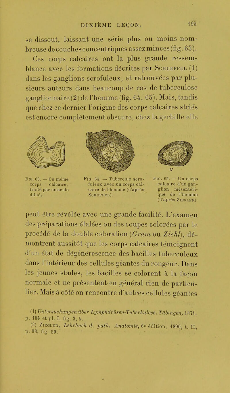 193 se dissout, laissant une série plus ou moins nom- breuse de couches concentriques assez minces (fig. 63). Ces corps calcaires ont la plus grande ressem- blance avec les formations décrites par Schueppel (1) dans les ganglions scrofuleux, et retrouvées par plu- sieurs auteurs dans beaucoup de cas de tuberculose ganglionnaire (2) de l'homme (fig. 64, 6S). Mais, tandis que chez ce dernier l'origine des corps calcaires striés est encore complètement obscure, chez la gerbille elle Fig. G3. — Ce même corps calcaire, traité par un acide dilué. FiG. 04. — Tubercule scro- fuleux avec un corps cal- caire de l'homme (d'après Schuppel). a Fig. 65. — Un corps calcaire d'un gan- glion mésentéri- que de l'homme (d'après Ziegler). peut être révélée avec une grande facilité. L'examen des préparations étalées ou des coupes colorées par le procédé de la double coloration [Gram ou Ziehl), dé- montrent aussitôt que les corps calcaires témoignent d'un état de dégénérescence des bacilles tuberculeux dans l'intérieur des cellules géantes du rongeur. Dans les jeunes stades, les bacilles se colorent à la façon normale et ne présentent' en général rien de particu- lier. Mais H côté on rencontre d'autres cellules géantes (1) Untersuohungen ûber Lymphdrûsen-Tiiberkulose. Tilbingen, 1871, p. 104 et pl. I, fig. 3, 4. (2) Ziegler, Lehrbuch d. pat/i. Anatomie, G édition, 1890, t II p. 98, fig. 50.