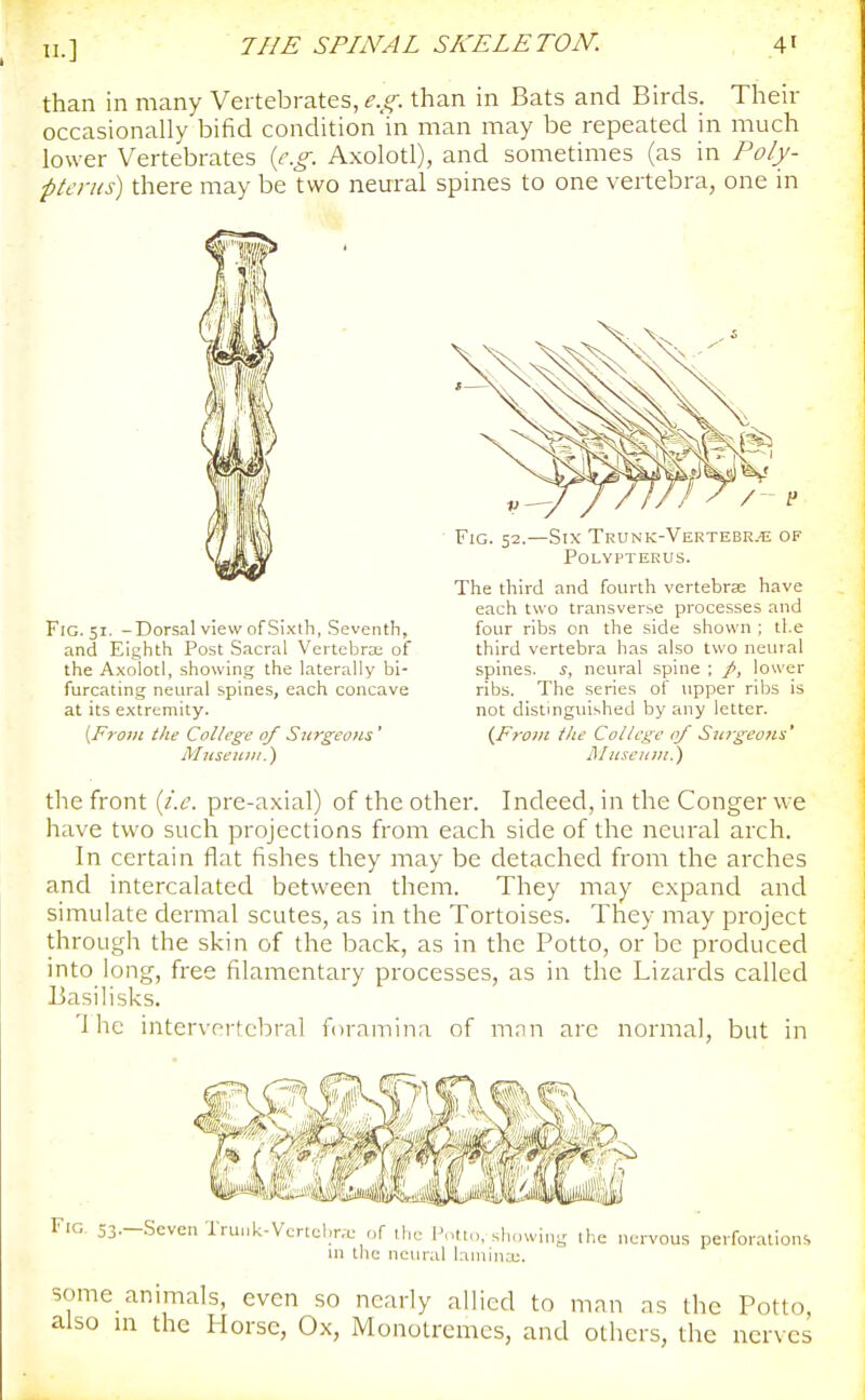 than in many Vertebrates, e.g. than in Bats and Birds. Their occasionally bifid condition in man may be repeated in much lower Vertebrates {e.g. Axolotl), and sometimes (as in Poly- ptenis) there may be two nem-al spines to one vertebra, one in Fig. 51. -Dorsal view of Si.fih, .Seventh, and Eighth Post Sacral Vertebra; of the Axolotl, showing the laterally bi- furcating neural spines, each concave at its extremity. {From the College of Surgeons' Museum.) ■ Fig. 52.—Six Trunk-Vertebr.-e of polyptekus. The third and fourth vertebrae have each two transverse processes and four ribs on the side shown ; the third vertebra has also two neural spines, s, neural .spine ; /, lower ribs. The series of upper ribs is not distinguished by any letter. (From the College of Surgeons' Ji/useum.) the front {i.e. pre-axial) of the other. Indeed, in the Conger we have two such projections from each side of the neural arch. In certain flat fishes they may be detached from the arches and intercalated between them. They may expand and simulate dermal scutes, as in the Tortoises. They may project through the skin of the back, as in the Potto, or be produced into long, free filamentary processes, as in the Lizards called Basilisks. 'Ihe intervertebral foramina of mnn are norma], but in Fig, 53--Scven Trunk-Vcrtebr.e of ihc I'ot,,,, slmwing the nervous perforations ni the neural laniin:.u. some animals, even so nearly allied to man as the Potto also in the Horse, Ox, Monotremcs, and others, the nerves