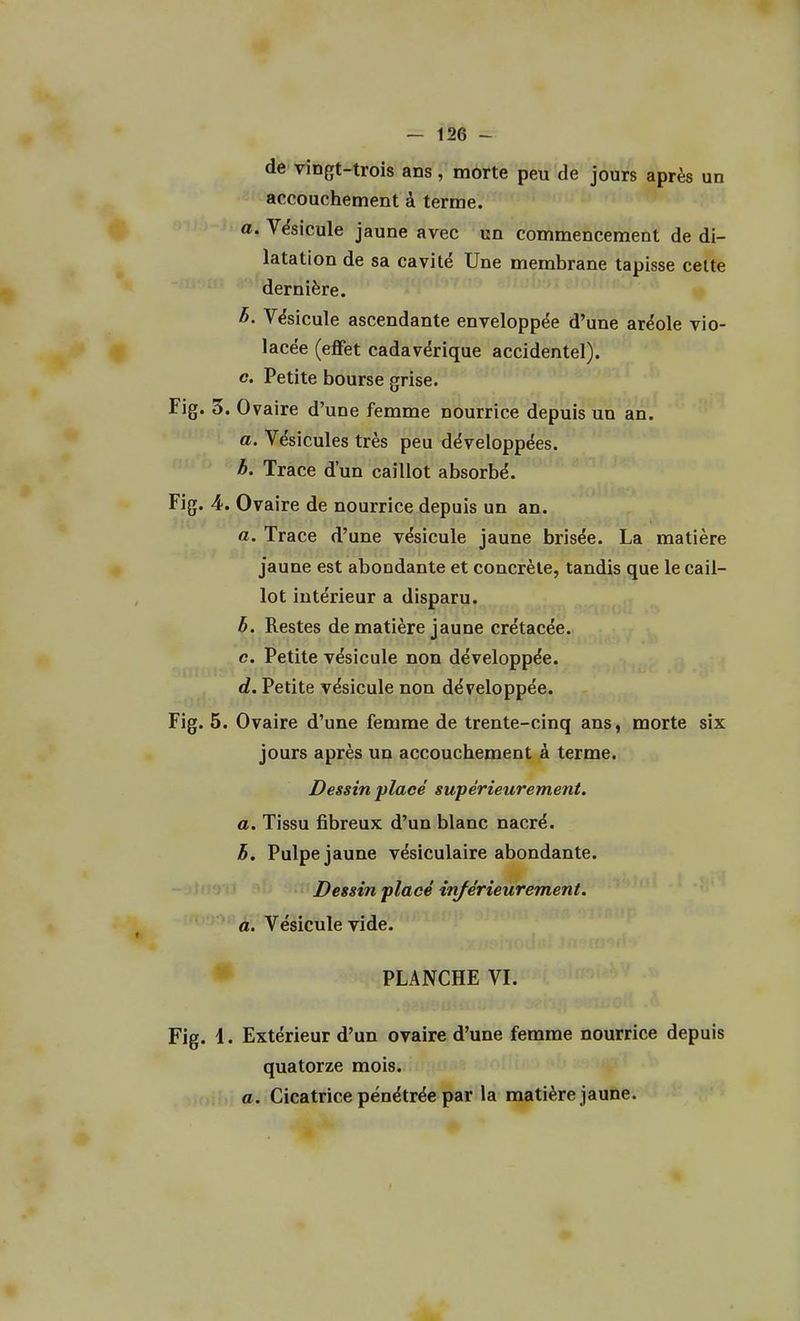 de vingt-trois ans, morte peu de jours après un accouchement à terme. a. Vésicule jaune avec un commencement de di- latation de sa cavité Une membrane tapisse cette dernière. 6. Vésicule ascendante enveloppée d'une aréole vio- lacée (effet cadavérique accidentel). c. Petite bourse grise. Fig. 3. Ovaire d'une femme nourrice depuis un an. a. Vésicules très peu développées. h. Trace d'un caillot absorbé. Fig. 4. Ovaire de nourrice depuis un an. a. Trace d'une vésicule jaune brisée. La matière jaune est abondante et concrète, tandis que le cail- lot intérieur a disparu. h. Restes de matière jaune crétacée, e. Petite vésicule non développée. d. Petite vésicule non développée. Fig. 5. Ovaire d'une femme de trente-cinq ans, morte six jours après un accouchement à terme. Dessin placé supérieurement, a. Tissu fibreux d'un blanc nacré. h. Pulpe jaune vésiculaire abondante. Dessin placé inférieurement. a. Vésicule vide. PLANCHE VI. Fig. i. Extérieur d'un ovaire d'une femme nourrice depuis quatorze mois. a. Cicatrice pénétrée par la matière jaune.