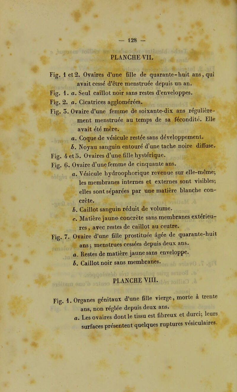 PLANCHE VII. Fig. 1 et2. Ovaires d'une fille de quarante-huit ans, qui avait cessé d'être menstruée depuis un an. Fig. 1. a. Seul caillot noir sans restes d'enveloppes. Fig. 2. a. Cicatrices agglomérées. Fig. 5. Ovaire d'une femme de soixante-dix ans régulière- ment menstruée au temps de sa fécondité. Elle avait été mère. a. Coque de vésicule restée sans développement. h. Noyau sanguin entouré d'une tache noire diffuse. Fig. 4 et 5. Ovaires d'une fille hystérique. Fig. 6. Ovaire d'une femme de cinquante ans. a. Vésicule hydroophorique revenue sur elle-même; les membranes internes et externes sont visibles; elles sont séparées par une matière blanche con- crète. b. Caillot sanguin réduit de volume. c. Matière jaune concrète sans membranes extérieu- res , avec restes de caillot au ceutre. Fig. 7. Ovaire d'une fille prostituée âgée de quarante-huit ans ; menstrues cessées depuis deux ans. a. Restes de matière jaune sans enveloppe. h. Caillot noir sans membranes. PLANCHE VIII. Fig. 4. Organes génitaux d'une fille vierge, morte à trente ans, non réglée depuis deux ans. a. Les ovaires dont le tissu est fibreux et durci; leurs surfaces présentent quelques ruptures vésiculaires.