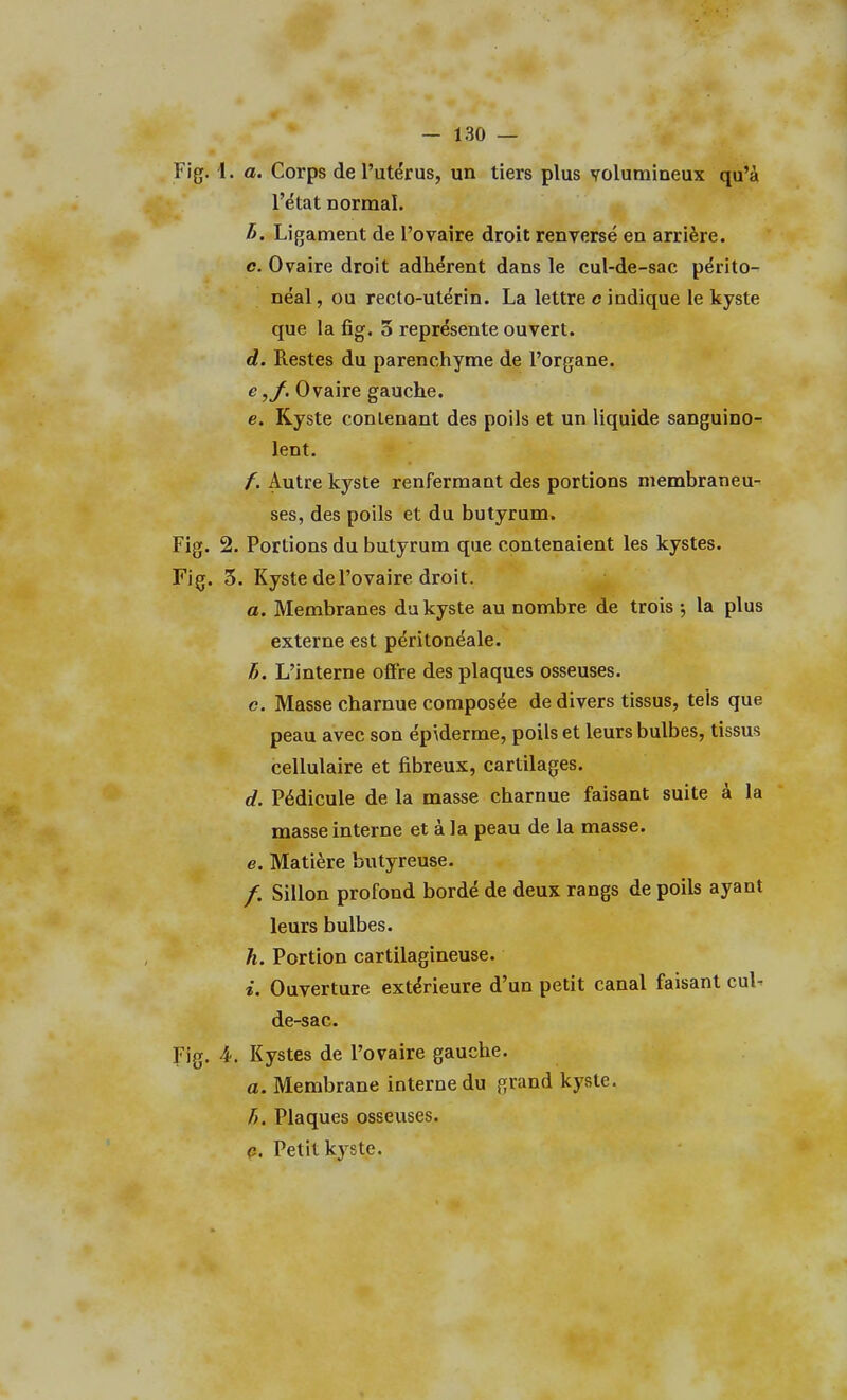 Fig. 1. a. Corps de l'utérus, un tiers plus volumineux qu'à l'état normal. />. Ligament de l'ovaire droit renversé en arrière. c. Ovaire droit adhérent dans le cul-de-sac périto- néal, ou recto-utérin. La lettre c indique le kyste que la fig. 5 représente ouvert. d. Restes du parenchyme de l'organe. e ,f. Ovaire gauche. e. Kyste contenant des poils et un liquide sanguino- lent. /. Autre kyste renfermant des portions membraneu- ses, des poils et du butyrum. Fig. 2. Portions du butyrum que contenaient les kystes. Fig. 5. Kyste de l'ovaire droit. a. Membranes du kyste au nombre de trois ; la plus externe est péritonéale. h. L'interne offre des plaques osseuses, e. Masse charnue composée de divers tissus, tels que peau avec son épiderme, poils et leurs bulbes, tissus cellulaire et fibreux, cartilages. d. Pédicule de la masse charnue faisant suite à la masse interne et à la peau de la masse. e. Matière butyreuse. /. Sillon profond bordé de deux rangs de poils ayant leurs bulbes. h. Portion cartilagineuse. s. Ouverture extérieure d'un petit canal faisant cul- de-sac. Fig. 4. Kystes de l'ovaire gauche. a. Membrane interne du grand kyste. h. Plaques osseuses. 0. Petit kyste.