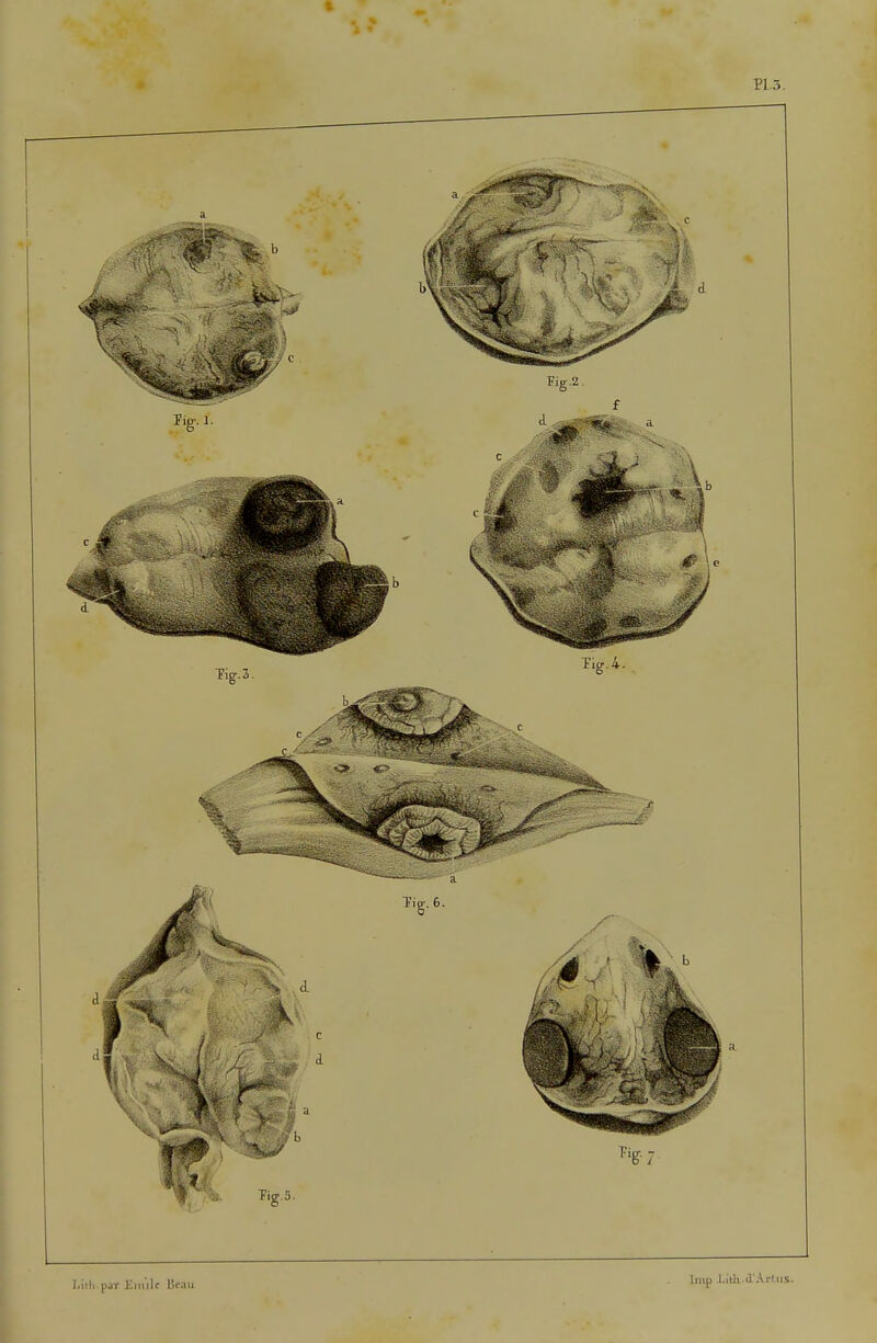 î.itli par ilmilr Beau Inip l.itli J'Arins.
