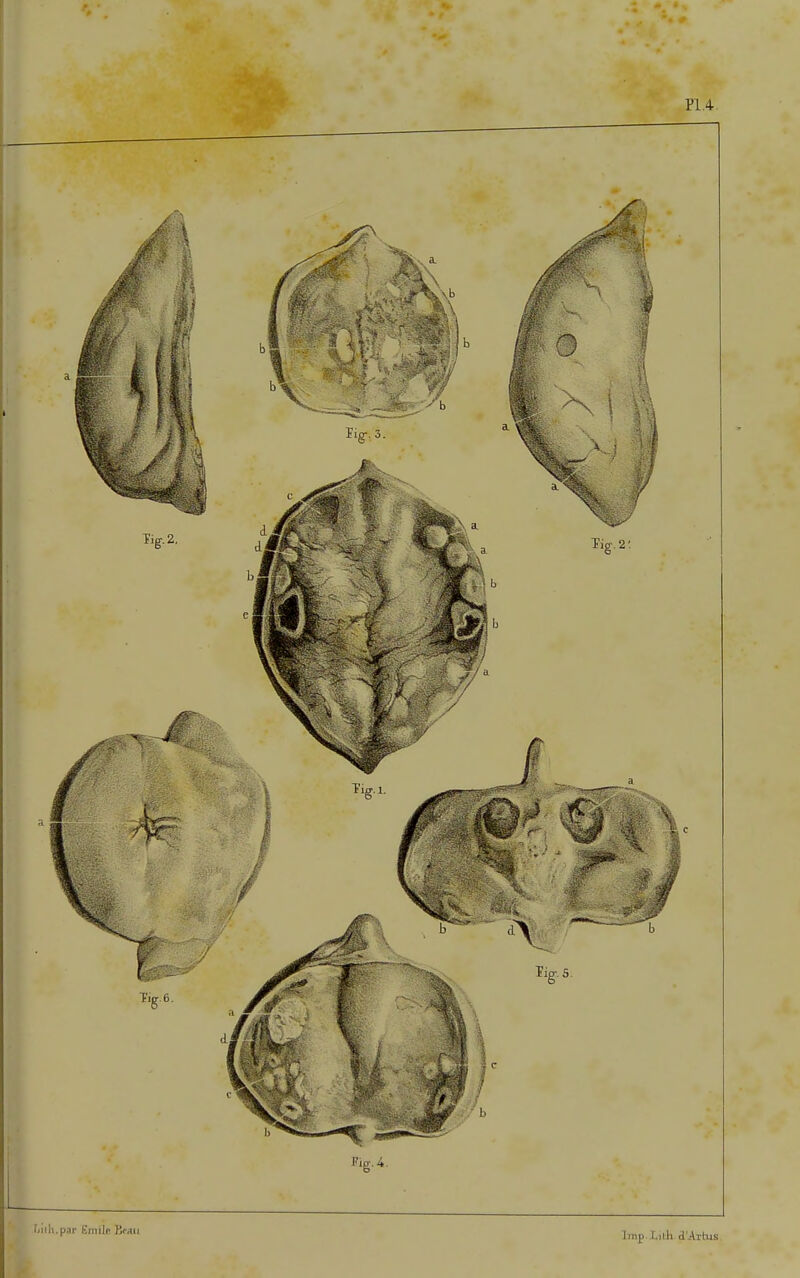 PI .4 'mil.par Ëniilp BrMii Imp l.ilh d'Ailus