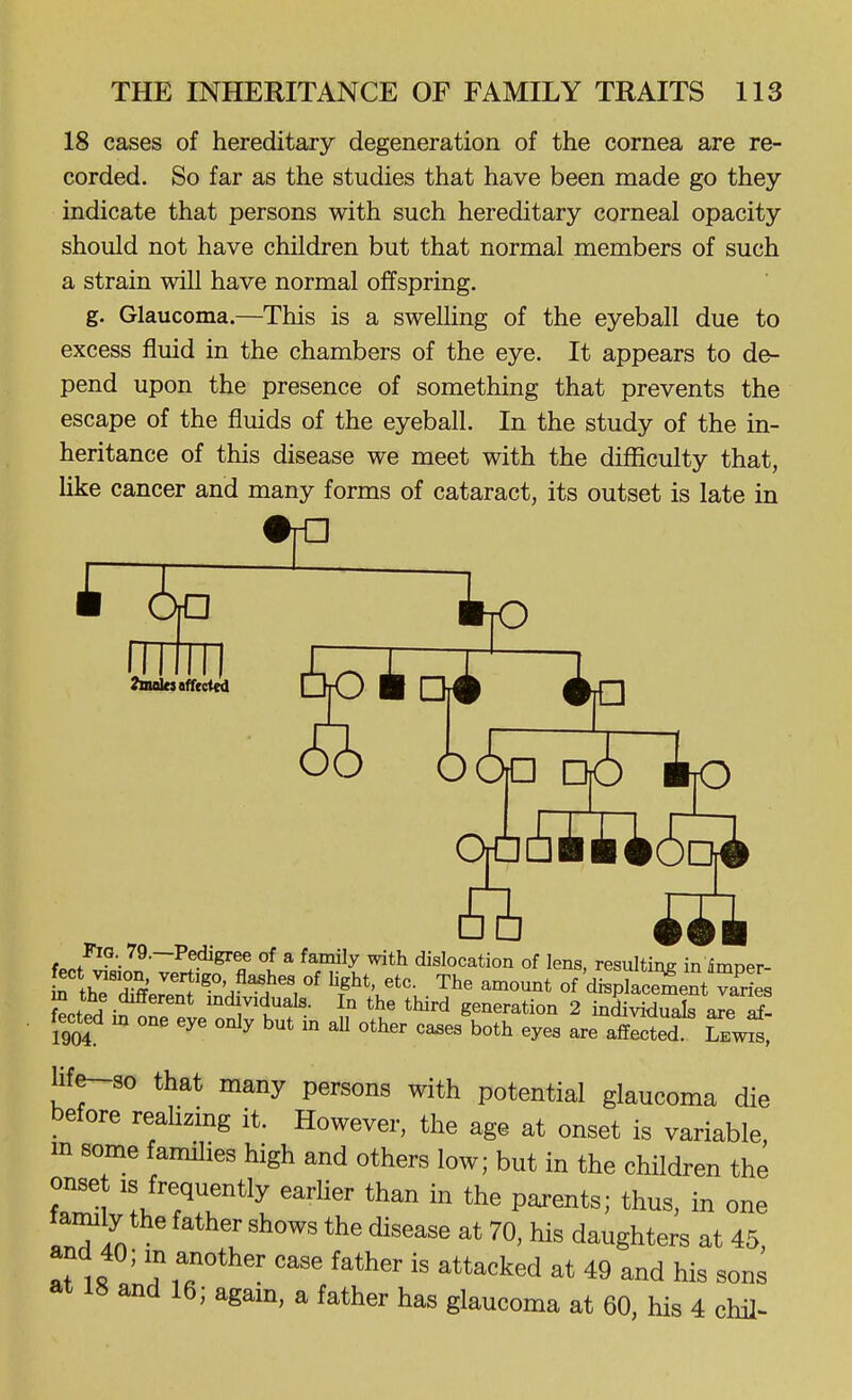 18 cases of hereditary degeneration of the cornea are re- corded. So far as the studies that have been made go they indicate that persons with such hereditary corneal opacity should not have children but that normal members of such a strain will have normal offspring. g. Glaucoma.—This is a swelling of the eyeball due to excess fluid in the chambers of the eye. It appears to de- pend upon the presence of something that prevents the escape of the fluids of the eyeball. In the study of the in- heritance of this disease we meet with the difficulty that, like cancer and many forms of cataract, its outset is late in fBukttfftctei Ail t.ot^- 79.-Pedigree of a family with dislocation of lens, resulting in imper- fect vision, vertigo flashes of light, etc. The amount of displacement varies m the different individuals. In the third generation 2 inETal Je S fected m one eye only but in all other cases both eyes are aSed hfe^so that many persons with potential glaucoma die before reahzing it. However, the age at onset is variable, in some famihes high and others low; but in the children the onset IS frequently earlier than in the parents; thus, in one family the father shows the disease at 70, his daughters at 45, aMR '^^r ^''^'^'^ 49 and his sons at 18 and 16; agam, a father has glaucoma at 60, his 4 chil^