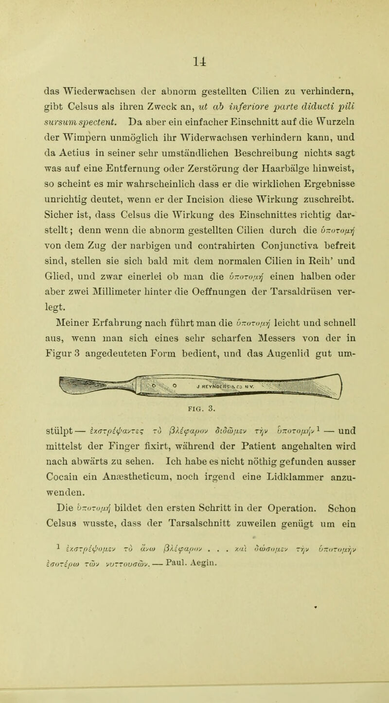 u das Wiederwachsen der abnorm gestellten Cilien zu verhindern, gibt Celsus als ihren Zweck an, ut ab inferiore parte diducti pili sursum spectent. Da aber ein einfacher Einschnitt auf die Wurzeln der Wimpern unmöglich ihr Widerwachsen verhindern kann, und da Aetius in seiner sehr umständlichen Beschreibung nichts sagt was auf eine Entfernung oder Zerstörung der Haarbälge hinweist, so scheint es mir wahrscheinlich dass er die wirklichen Ergebnisse unrichtig deutet, wenn er der Incision diese Wirkung zuschreibt. Sicher ist, dass Celsus die Wirkung des Einschnittes richtig dar- stellt ; denn wenn die abnorm gestellten Cilien durch die ö-mußrj von dem Zug der narbigen und contrahirten Conjunctiva befreit sind, stellen sie sich bald mit dem normalen Cilien in Reih' und Glied, und zwar einerlei ob man die ÖTtorofirj einen halben oder aber zwei Millimeter hinter die Oeffnungen der Tarsaldrüsen ver- legt. Meiner Erfahrung nach führt man die öxoTOftrj leicht und schnell aus, wenn man sich eines sehr scharfen Messers von der in Figur 3 angedeuteten Form bedient, und das Augenlid gut um- FIG. 3. stülpt— Ixozpiipavres ti) ß).(<pa.fj»v Sidw/isv rrjv oitorafujv*— und mittelst der Finger fixirt, während der Patient angehalten wird nach abwärts zu sehen. Ich habe es nicht nöthig gefunden ausser Cocain ein Anoestheticum, noch irgend eine Lidklammer anzu- wenden. Die bxoroprj bildet den ersten Schritt in der Operation. Schon Celsus wusste, dass der Tarsalschnitt zuweilen genügt um ein * ixffTpitpOfiev zu u\>u) ßkiipttpav . . . xal idwo/tsv rijv önoTOfiijV lattzipio ziüv •juzzouamj. — Paul. Aegin.