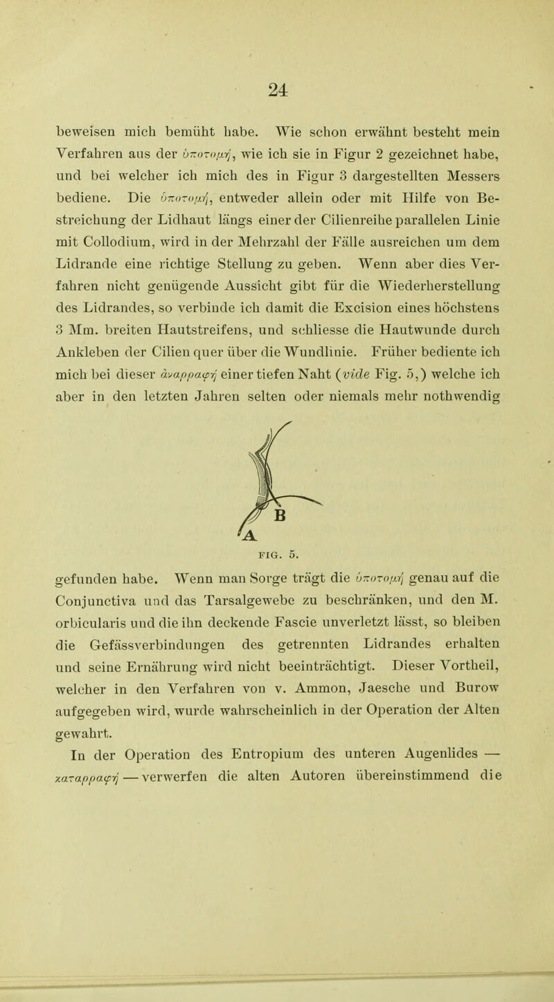 beweisen mich bemüht habe. Wie schon erwähnt besteht mein Verfahren aus der bnoTOfirf, wie ich sie in Figur 2 gezeichnet habe, und bei welcher ich mich des in Figur 3 dargestellten Messers bediene. Die u-ort>tjJh entweder allein oder mit Hilfe von Be- streichung der Lidhaut längs einer der Cilienreihe parallelen Linie mit Collodium, wird in der Mehrzahl der Fälle ausreichen um dem Lidrande eine richtige Stellung zu geben. Wenn aber dies Ver- fahren nicht genügende Aussicht gibt für die Wiederherstellung des Lidrandes, so verbinde ich damit die Excision eines höchstens 3 Mm. breiten Hautstreifens, und schliesse die Hautwunde durch Ankleben der Cilien quer über die Wundlinie. Früher bediente ich mich bei dieser ävappa<p-/j einer tiefen Naht (viele Fig. 5,) welche ich aber in den letzten Jahren selten oder niemals mehr nothwendig FIG. 5. gefunden habe. Wenn man Sorge trägt die bicozoß^ genau auf die Conjunctiva und das Tarsalgewebe zu beschränken, und den M. orbicularis und die ihn deckende Fascie unverletzt lässt, so bleiben die Gefässverbindungen des getrennten Lidrandes erhalten und seine Ernährung wird nicht beeinträchtigt. Dieser Vortheil, welcher in den Verfahren von v. Ammon, Jaesche und Burow aufgegeben wird, wurde wahrscheinlich in der Operation der Alten gewahrt. In der Operation des Entropium des unteren Augenlides — zaTappcuprj — verwerfen die alten Autoren übereinstimmend die