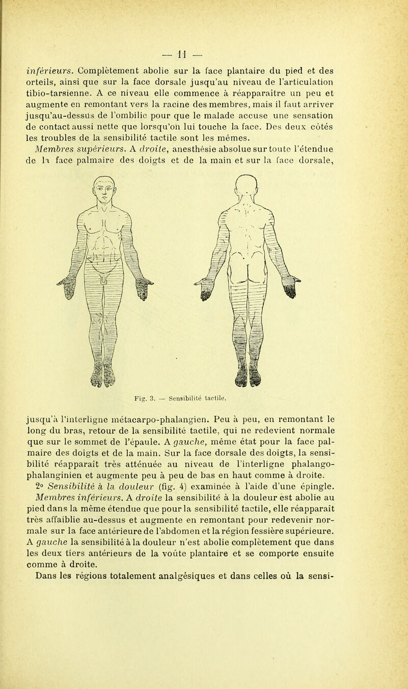 inférieurs. Complètement abolie sur la face plantaire du pied et des orteils, ainsi que sur la face dorsale jusqu'au niveau de l'articulation tibio-tarsienne. A ce niveau elle commence à réapparaître un peu et augmente en remontant vers la racine des membres, mais il faut arriver jusqu'au-dessus de l'ombilic pour que le malade accuse une sensation de contact aussi nette que lorsqu'on lui touche la face. Des deux cotés les troubles de la sensibilité tactile sont les mêmes. Membres supérieurs. A droite, anesthésie absolue sur toute l'étendue de la face palmaire des doigts et de la main et sur la face dorsale, Fig. 3. — Sensibilité tactile. jusqu'eà l'interligne métacarpo-phalangien. Peu à peu, en remontant le long du bras, retour de la sensibilité tactile, qui ne redevient normale que sur le sommet de l'épaule. A gauche, même état pour la face pal- maire des doigts et de la main. Sur la face dorsale des doigts, la sensi- bilité réapparaît très atténuée au niveau de l'interligne phalango- phalanginien et augmente peu à peu de bas en haut comme à droite. 2° Sensibilité à la douleur (fig. 4) examinée à l'aide d'une épingle. Membres inférieurs. A droite la sensibilité à la douleur est abolie au pied dans la même étendue que pour la sensibilité tactile, elle réapparaît très affaiblie au-dessus et augmente en remontant pour redevenir nor- male sur la face antérieure de l'abdomen et la région fessière supérieure. A gauche la sensibilité à la douleur n'est abolie complètement que dans les deux tiers antérieurs de la voûte plantaire et se comporte ensuite comme à droite. Dans les régions totalement analgésiques et dans celles où la sensi-