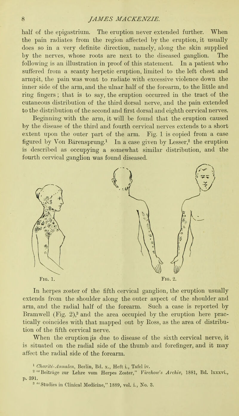 half of the epigastrium. The eruption never extended further. When the pain radiates from the region affected by the eruption, it usually does so in a very definite direction, namely, along the skin supplied by the nerves, whose roots are next to the diseased ganglion. The following is an illustration in proof of this statement. In a patient who suffered from a scanty herpetic eruption, limited to the left chest and armpit, the pain was wont to radiate with excessive violence down the inner side of the arm, and the ulnar half of the forearm, to the little and ring fingers ; that is to say, the eruption occurred in the tract of the cutaneous distribution of the third dorsal nerve, and the pain extended to the distribution of the second and first dorsal and eighth cervical nerves. Beginning with the arm, it will be found that the eruption caused by the disease of the third and fourth cervical nerves extends to a short extent upon the outer part of the arm. Fig. 1 is copied from a case figured by Von Btirensprung.^ In a case given by Lesser,^ the eruption is described as occupying a somewhat similar distribution, and the fourth cervical ganglion was found diseased. In herpes zoster of the fifth cervical ganghon, the eruption usually extends from the shoulder along the outer aspect of the shoulder and arm, and the radial half of the forearm. Such a case is reported by Bramwell (Fig. 2),^ and the area occupied by the eruption here prac- tically coincides with that mapped out by Boss, as the area of distribu- tion of the fifth cervical nerve. When the eruption jis due to disease of the sixth cervical nerve, it is situated on the radial side of the thumb and forefinger, and it may affect the radial side of the forearm. ^ Chnrite-Annalen, Berlin, Bd. x.. Heft i., Tafel iv. -Beitrage zur Lehre vom Herpes Zoster, Virchow's Archiv, 1881, Bd. Ix.xxvi., p. 391. Studies ill Clinical Medicine, 1889, vol. i.. No. 3.